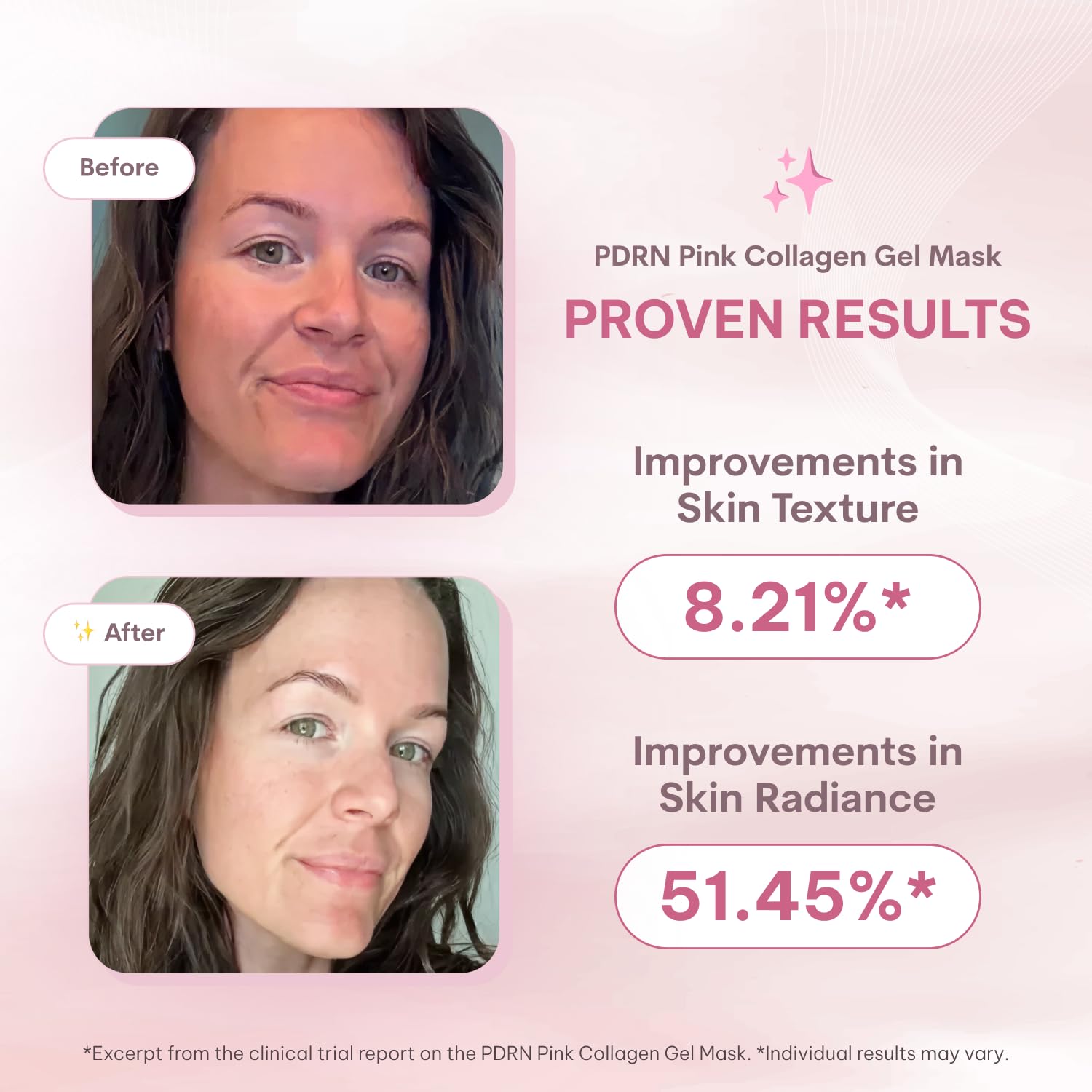Salmon PDRN Collagen Mask – Korean Skin care Gel Face Mask for - Quasi