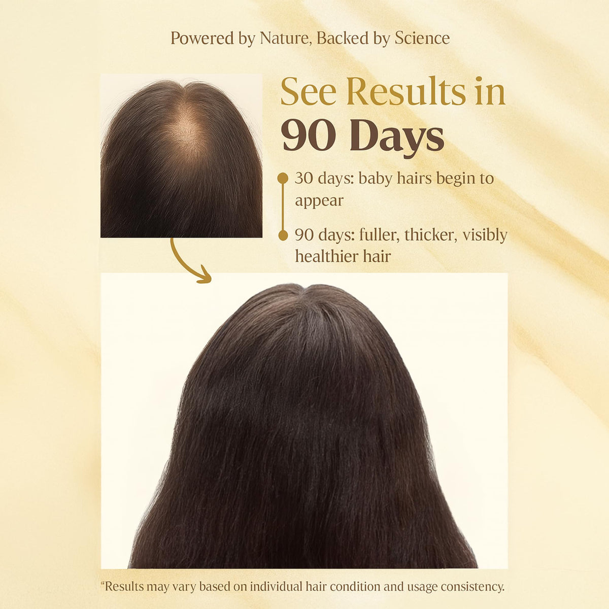 D Cherlane Hair Growth Oil Scalp Treatment with Rosemary - D'Cherlane Official Imagery - 6