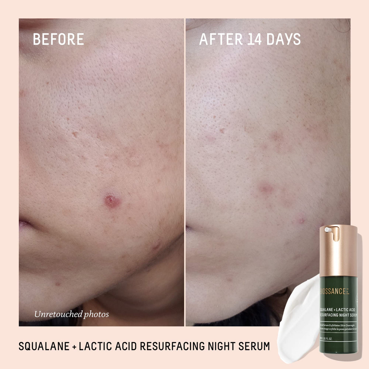 BIOSSANCE Rapid Radiance Set - Premium Selection Official Imagery - 5