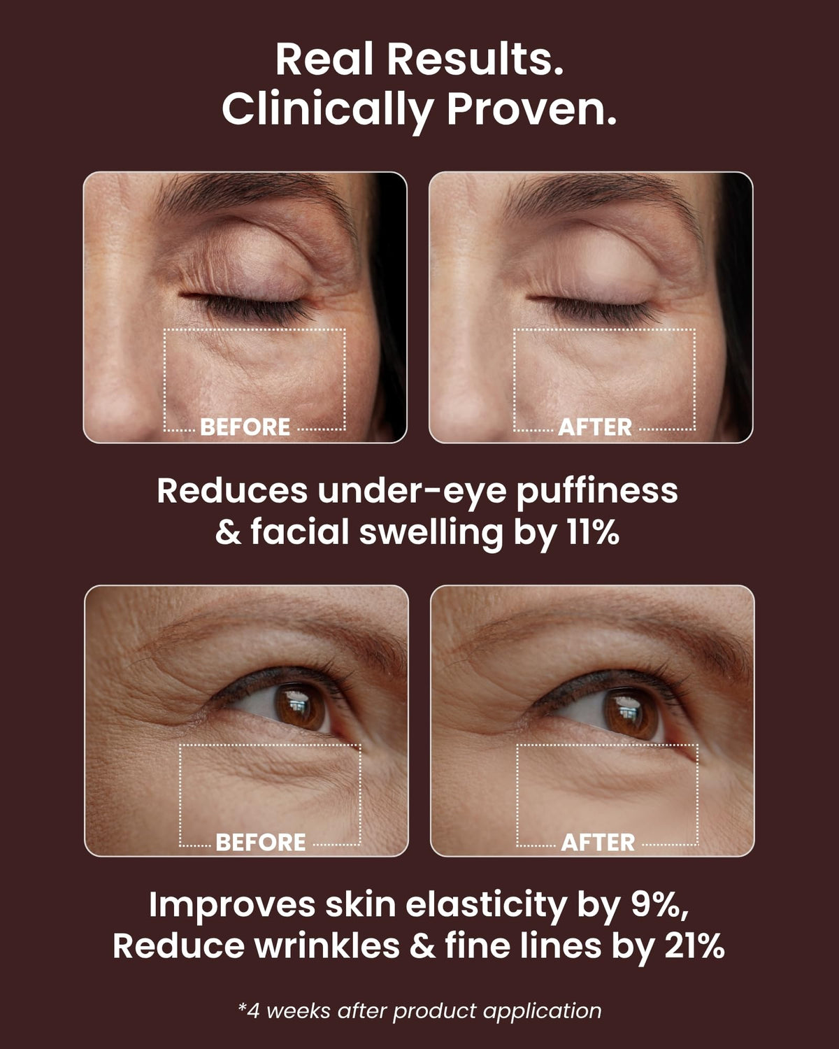Ice Roll Serum for Face Puffy Eyes Under Eye Bags - VAROL Official Imagery - 7