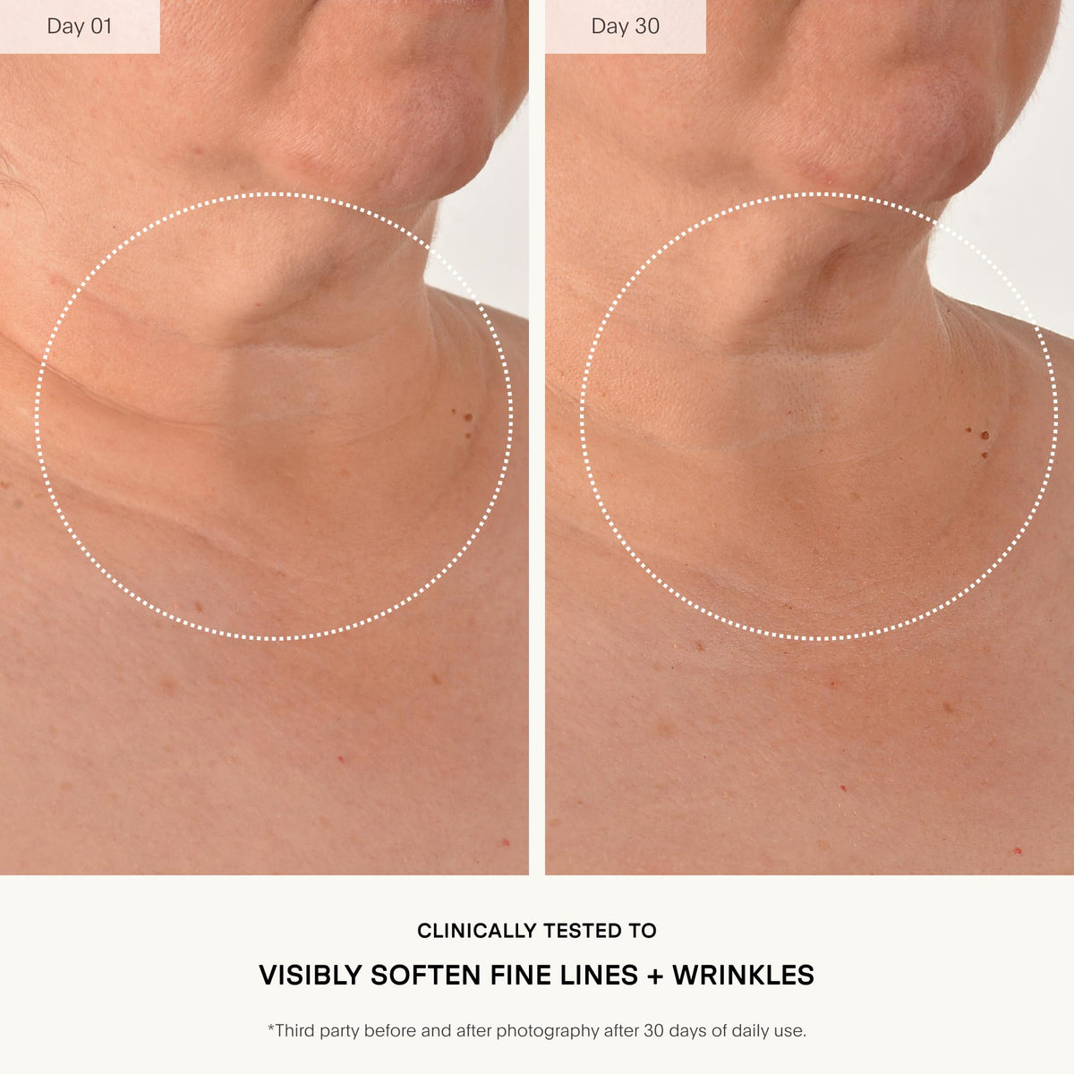 U Beauty The Sculpt Neck D collet Concentrate - U Beauty Official Imagery - 4