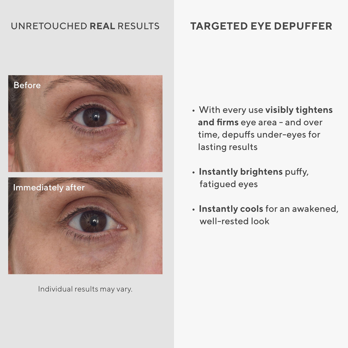 Murad Targeted Eye Depuffer - Premium Selection Official Imagery - 4