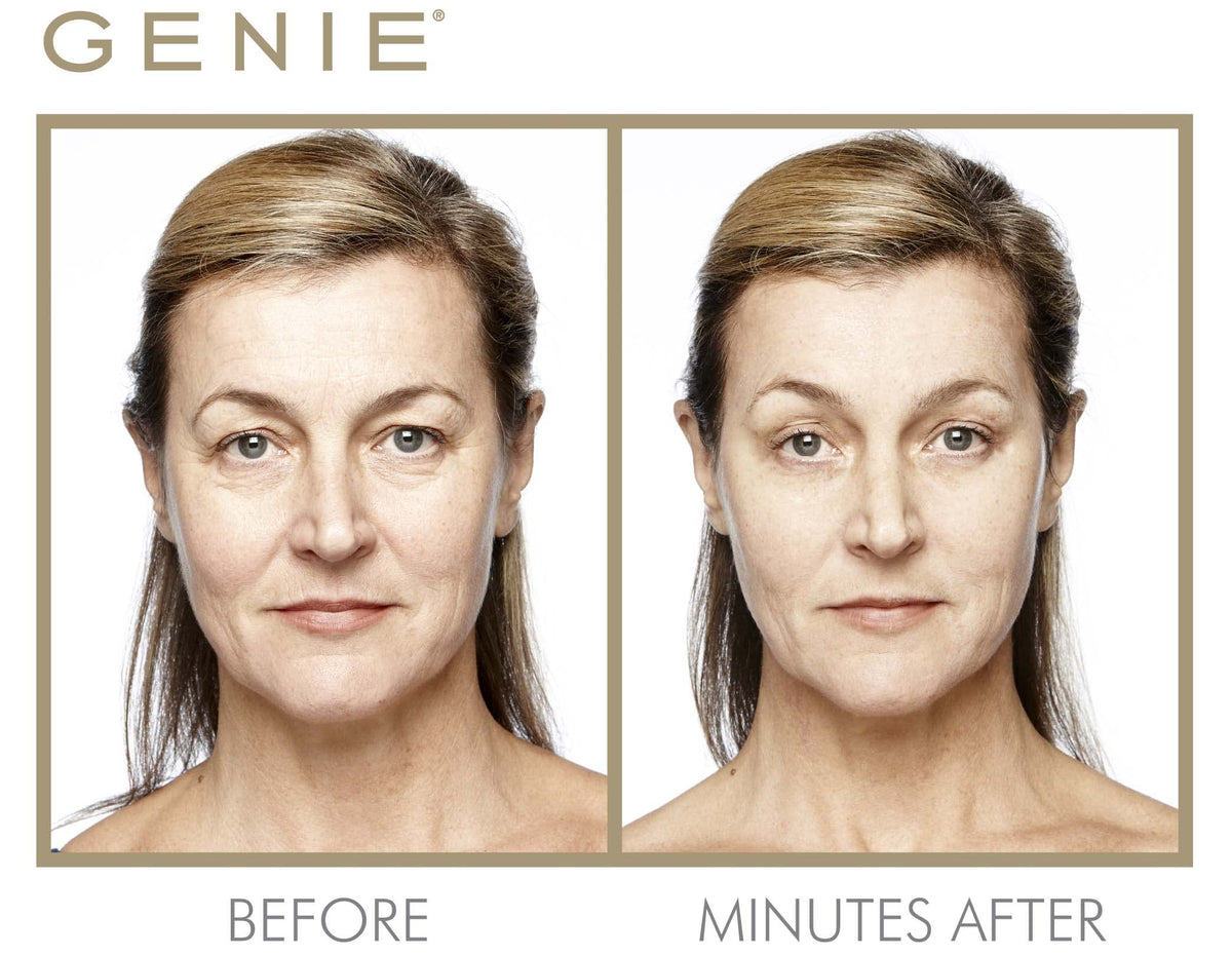 GENIE Instant Line Smoother - GENIE Official Imagery - 5