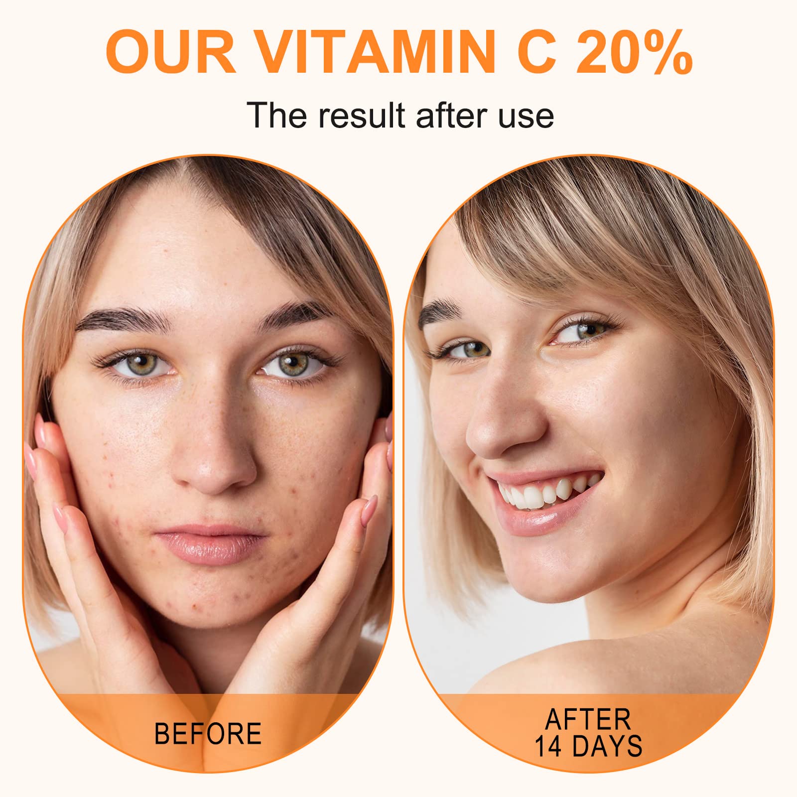 ELBBUB Premium 20% Vitamin C Serum For Face with Hyaluronic Acid, Retinol & - ELBBUB Official Product View 6