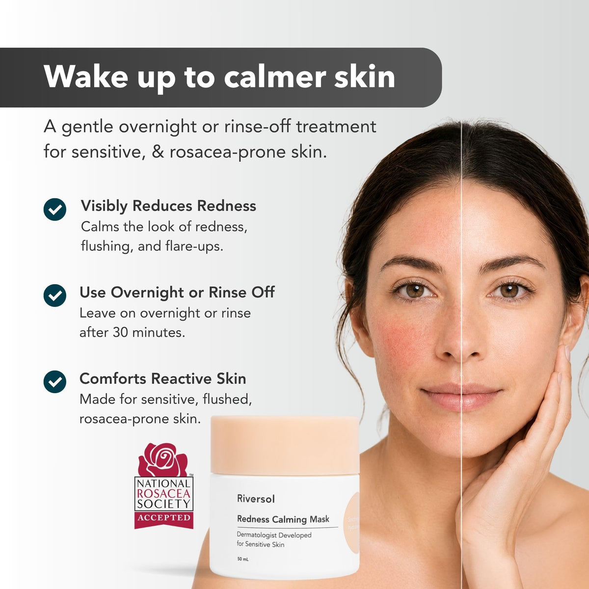 Redness Calming Cream for Rosacea Sensitive Skin - Riversol Official Imagery - 3