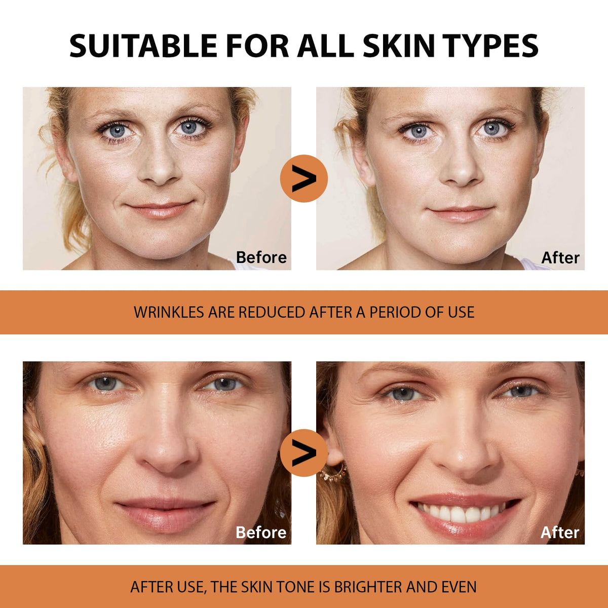 VGO Vitamin C Serum for Face Vit C Anti Aging Serum with - VGO Official Imagery - 7