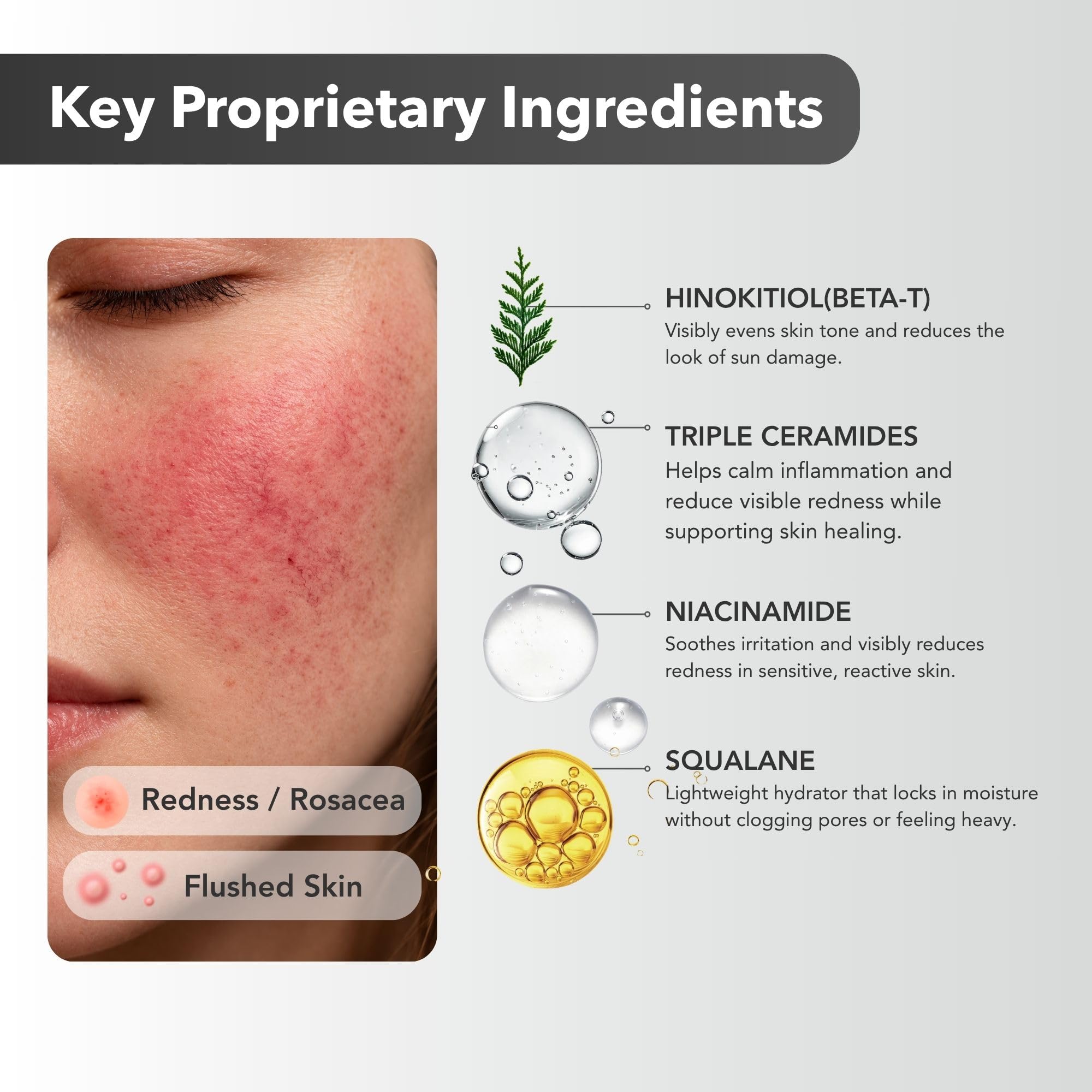 Redness Calming Cream for Rosacea Sensitive Skin - Riversol Official Imagery - 7