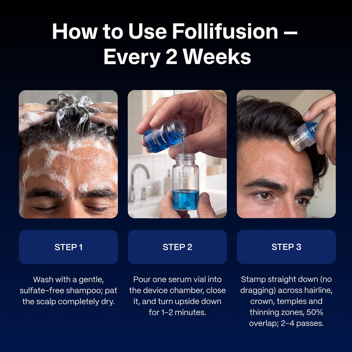 BlueForce Follifusion Hair Microinfusion System With Copper - Blueforce Official Imagery - 7