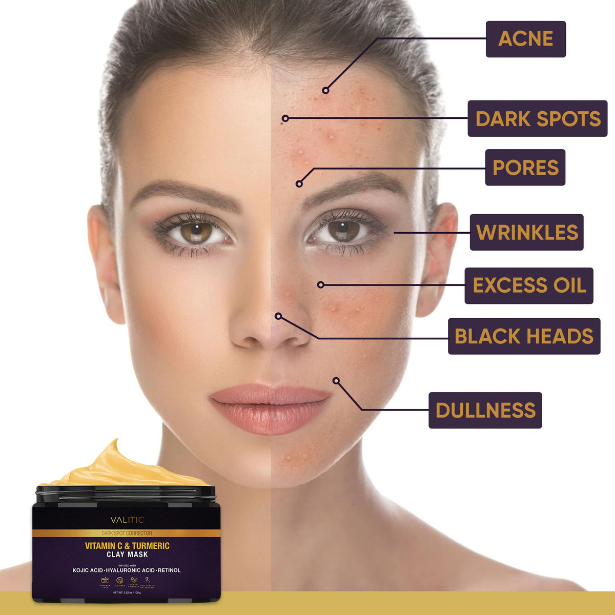 VALITIC Turmeric Vitamin C Clay Mask Face Dark Spot Remover - VALITIC Official Imagery - 7