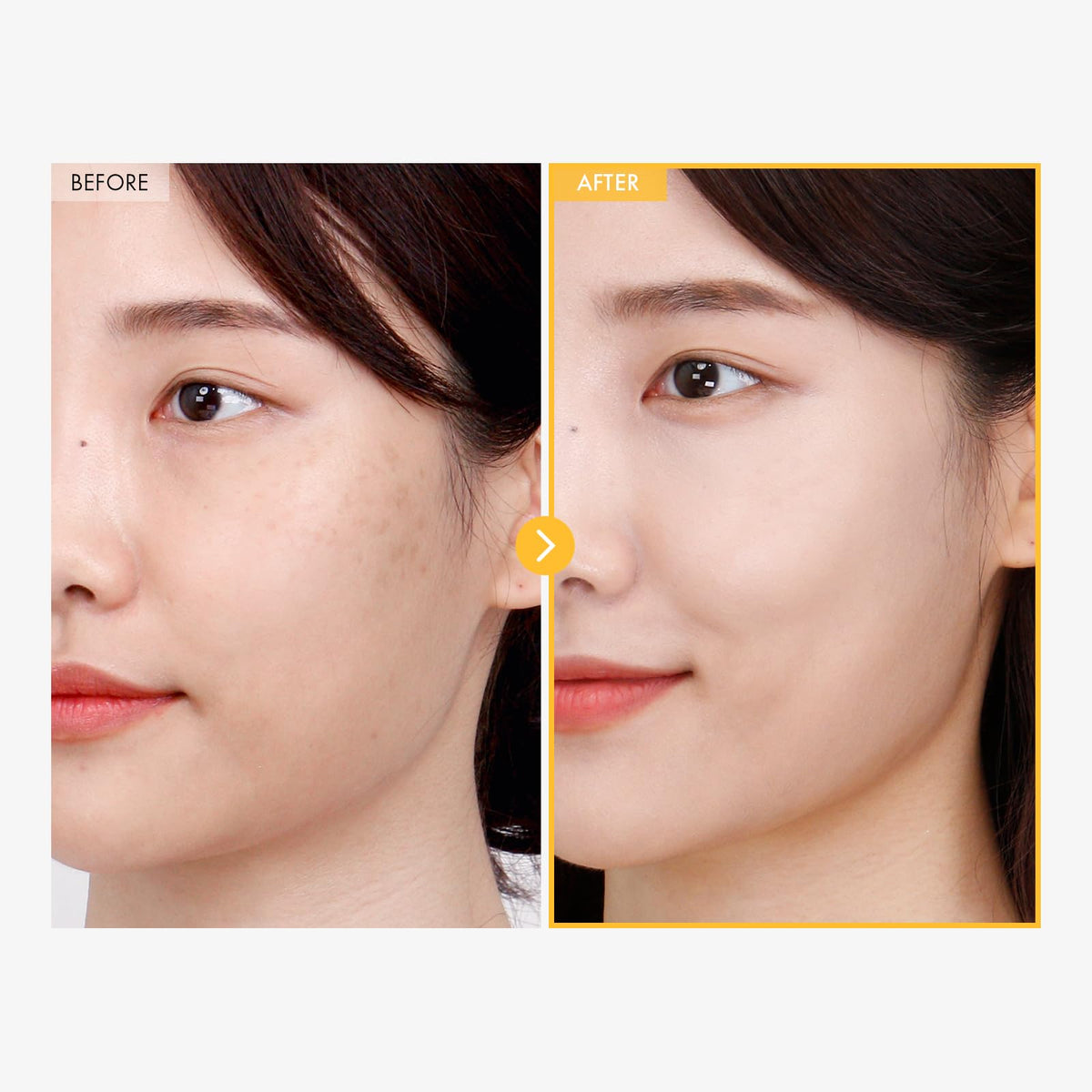 TOSOWOONG 8 Days Spot Cream for Dark Spots Freckles Uneven - TOSOWOONG Official Imagery - 4