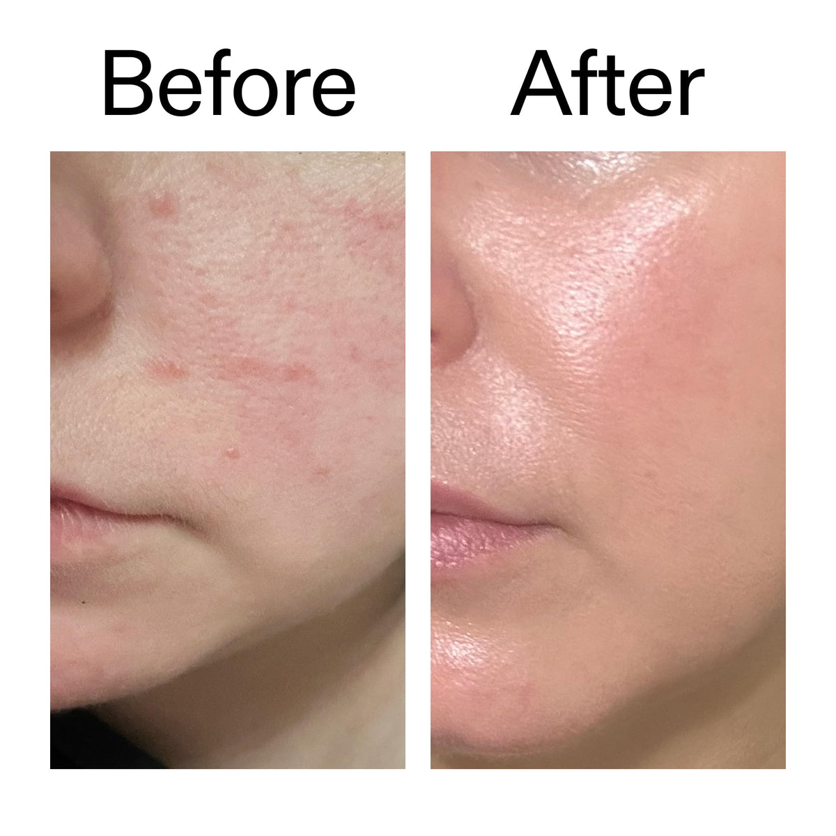 The INKEY List Exosome Hydro Glow Complex Enhances Skin - Premium Selection Official Imagery - 7