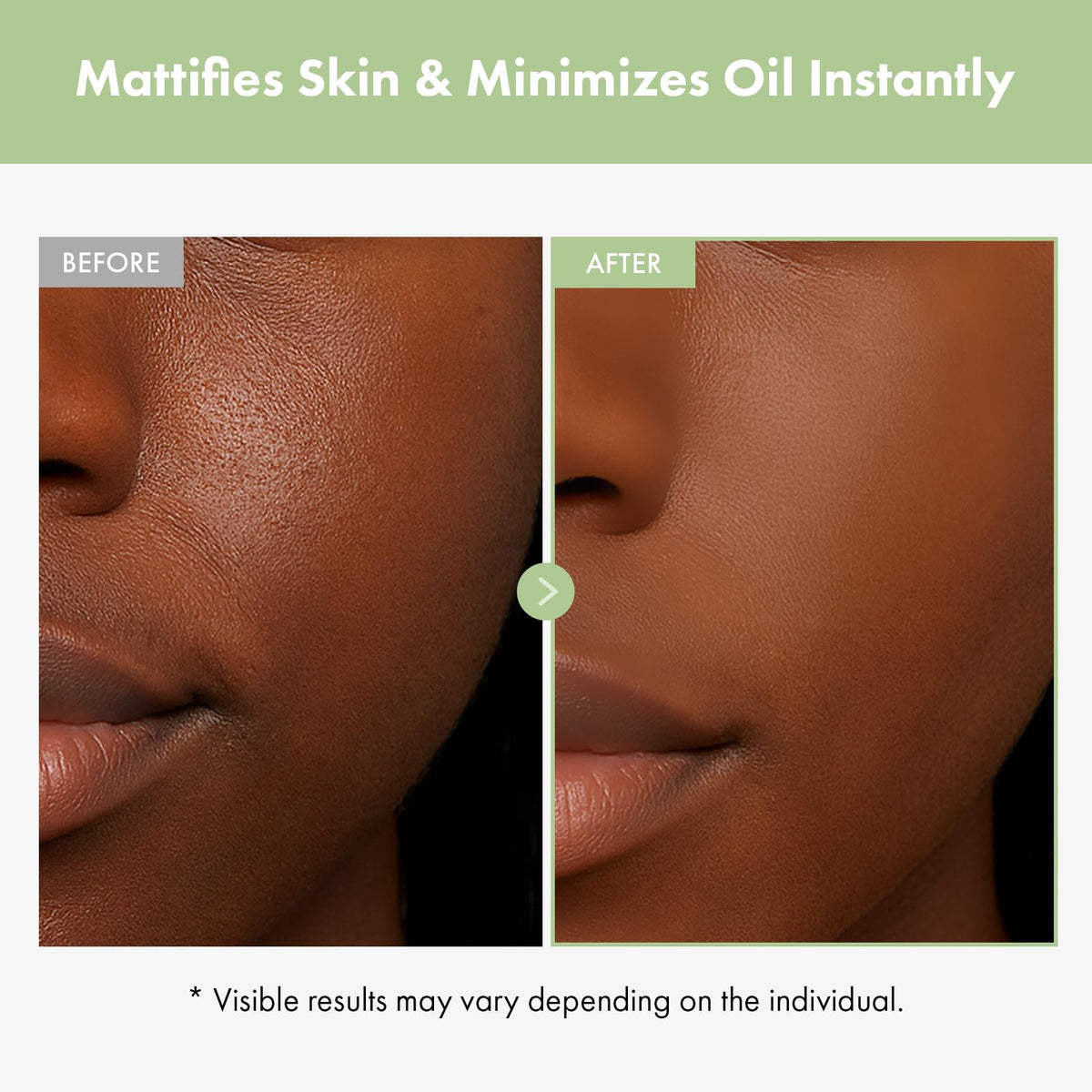 Ultimate Pore Control Duo TOSOWOONG Green Caviar Ampoule and - TOSOWOONG Official Imagery - 8