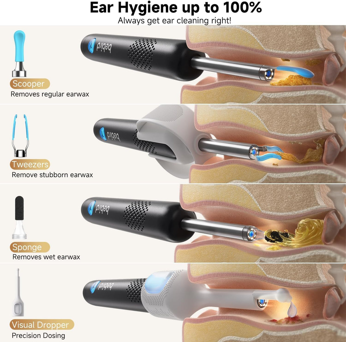 BEBIRD R1 Ultra Ear Wax Removal Tweezers 1296P HD Ear Camera - BEBIRD Official Imagery - 5