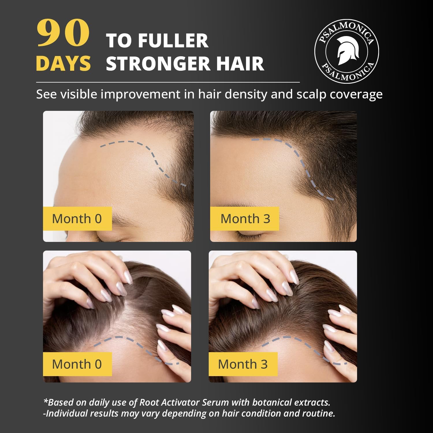 Psalmonica Hair Growth Serum - Root Activator Scalp Treatment for Hai - Psalmonica Official Product View 4
