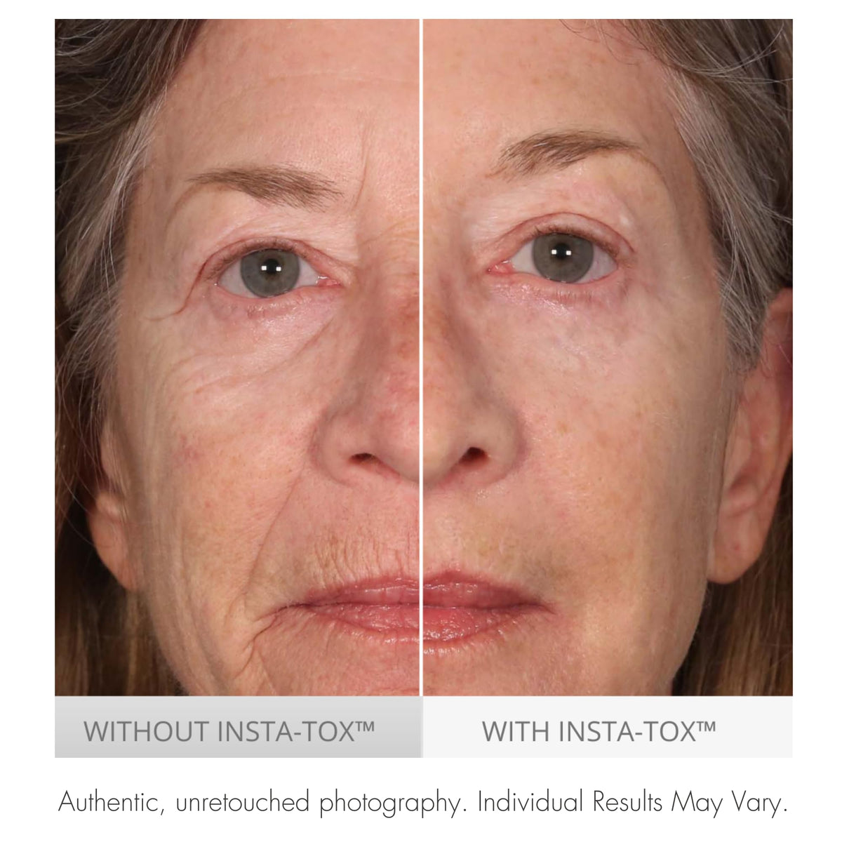 Serious Skincare INSTA TOX Instant Wrinkle Filler Face Serum - Serious Skincare Official Imagery - 6