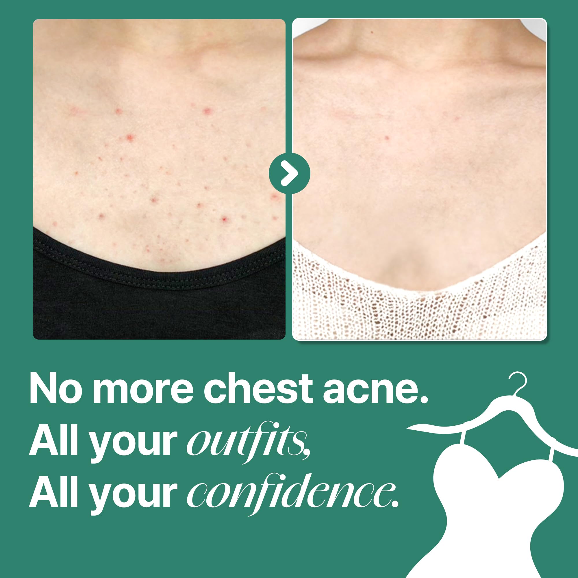 SOME BY MI AHA BHA PHA 30 Days Miracle Acne Clear Body Cleanser - View 6