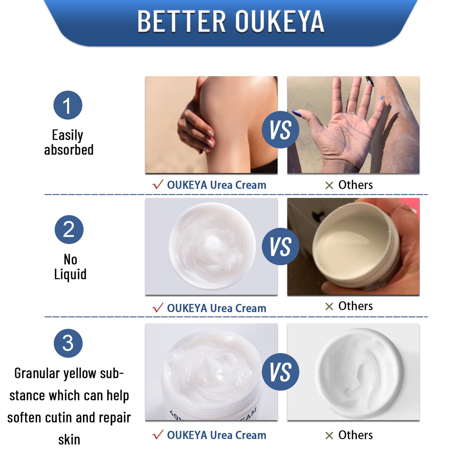 OUKEYA 40% Urea hand and foot moisturizer cream in a 5.29 oz jar, designed to hydrate and soothe dry skin.