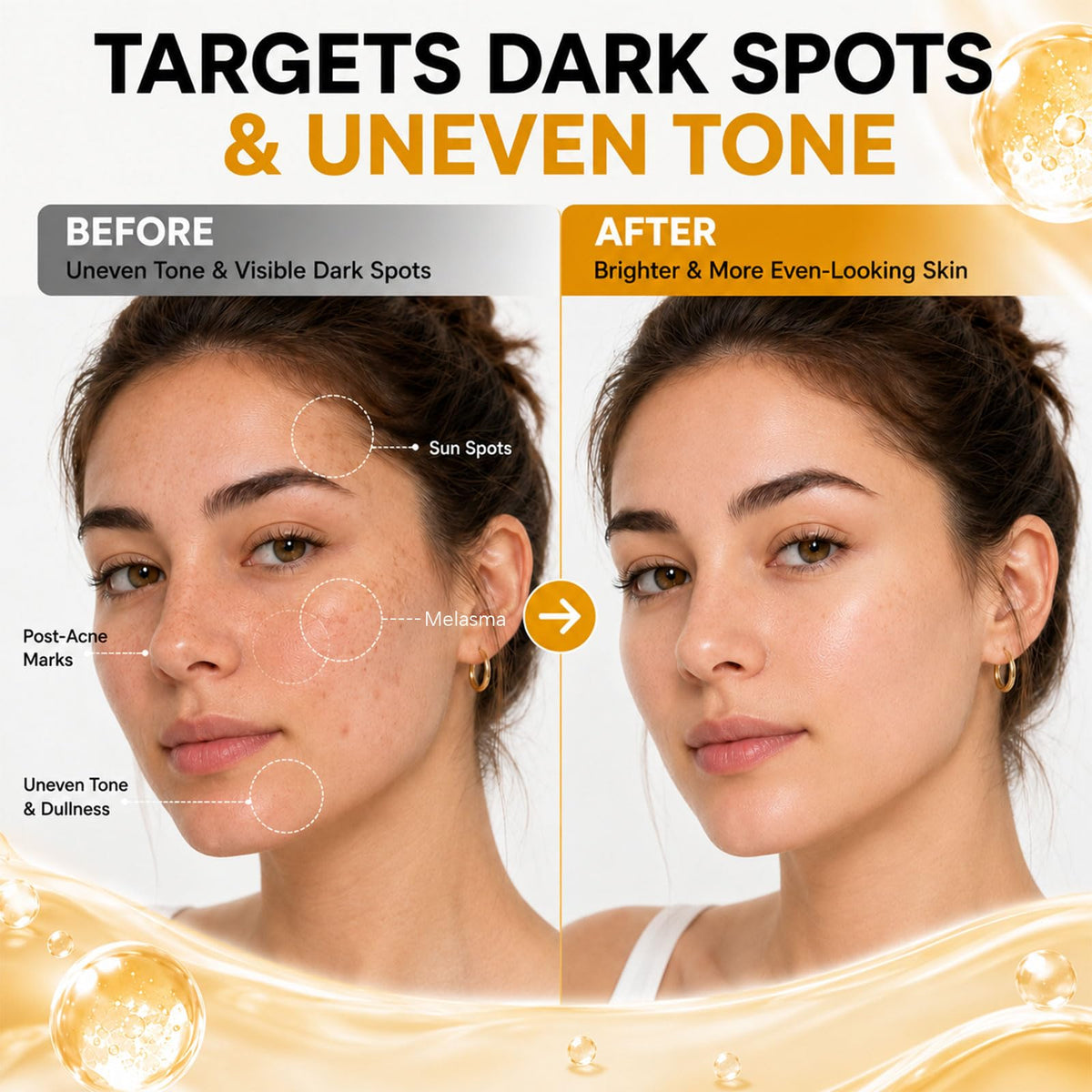 Tranexamic Acid Serum 5 for Face Dark Spot Uneven Skin Tone - medivita Official Imagery - 5