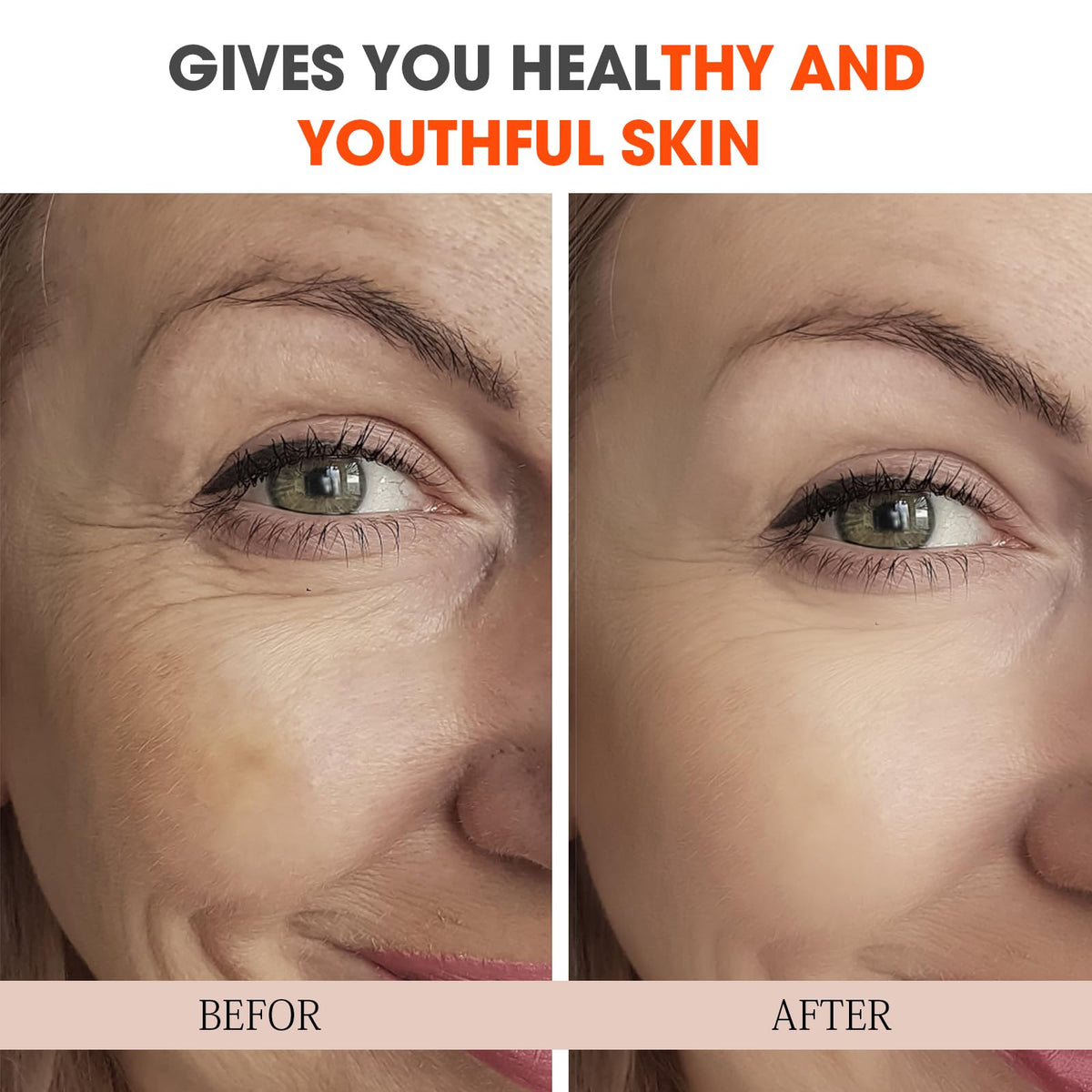 Super Vitamin C Serum for Women over 70 All In One Total - Nodfens Official Imagery - 7