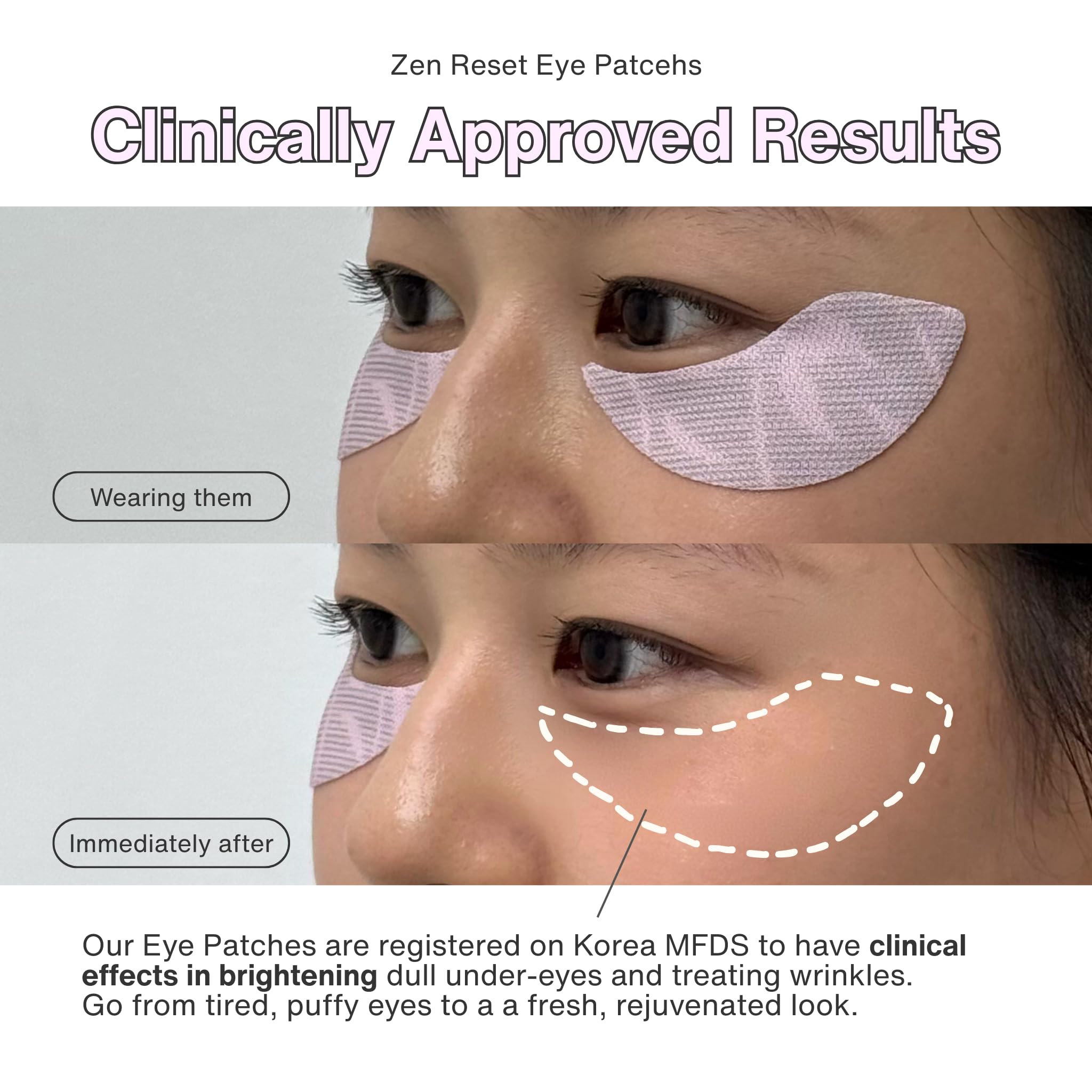 Zen Reset Eye Patches for Rejuvenating, Cooling, and Depuffing - AROOM