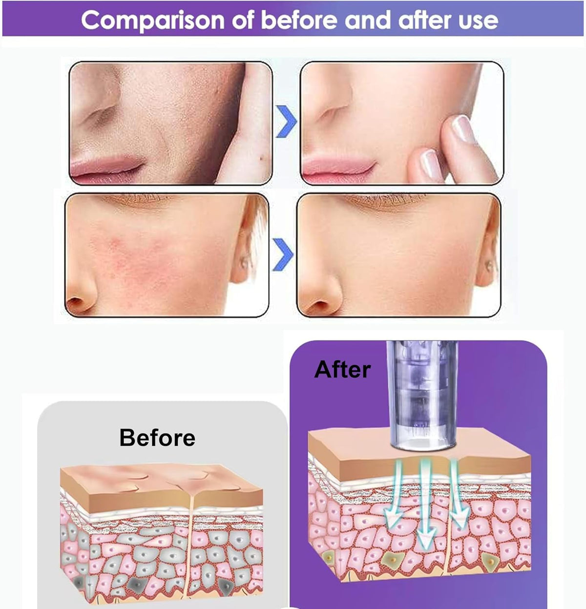 Elitzia Nano Crystal Skin Care Tools for Skin Rejuvenation - Elitzia Official Imagery - 3