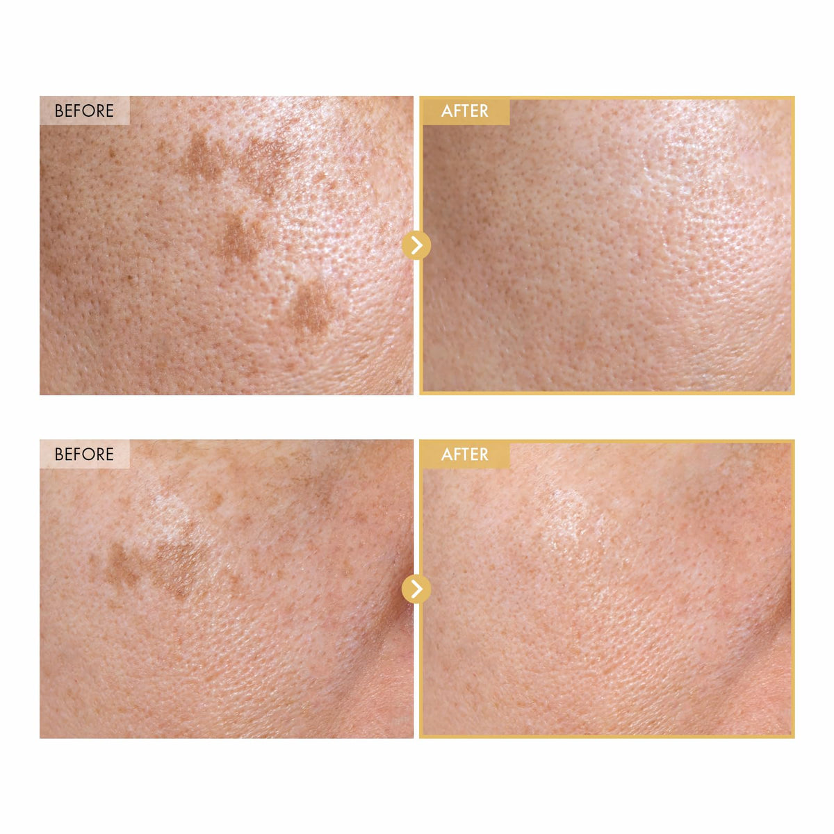 TOSOWOONG Glass Skin Recovery Bundle - TOSOWOONG Official Imagery - 5