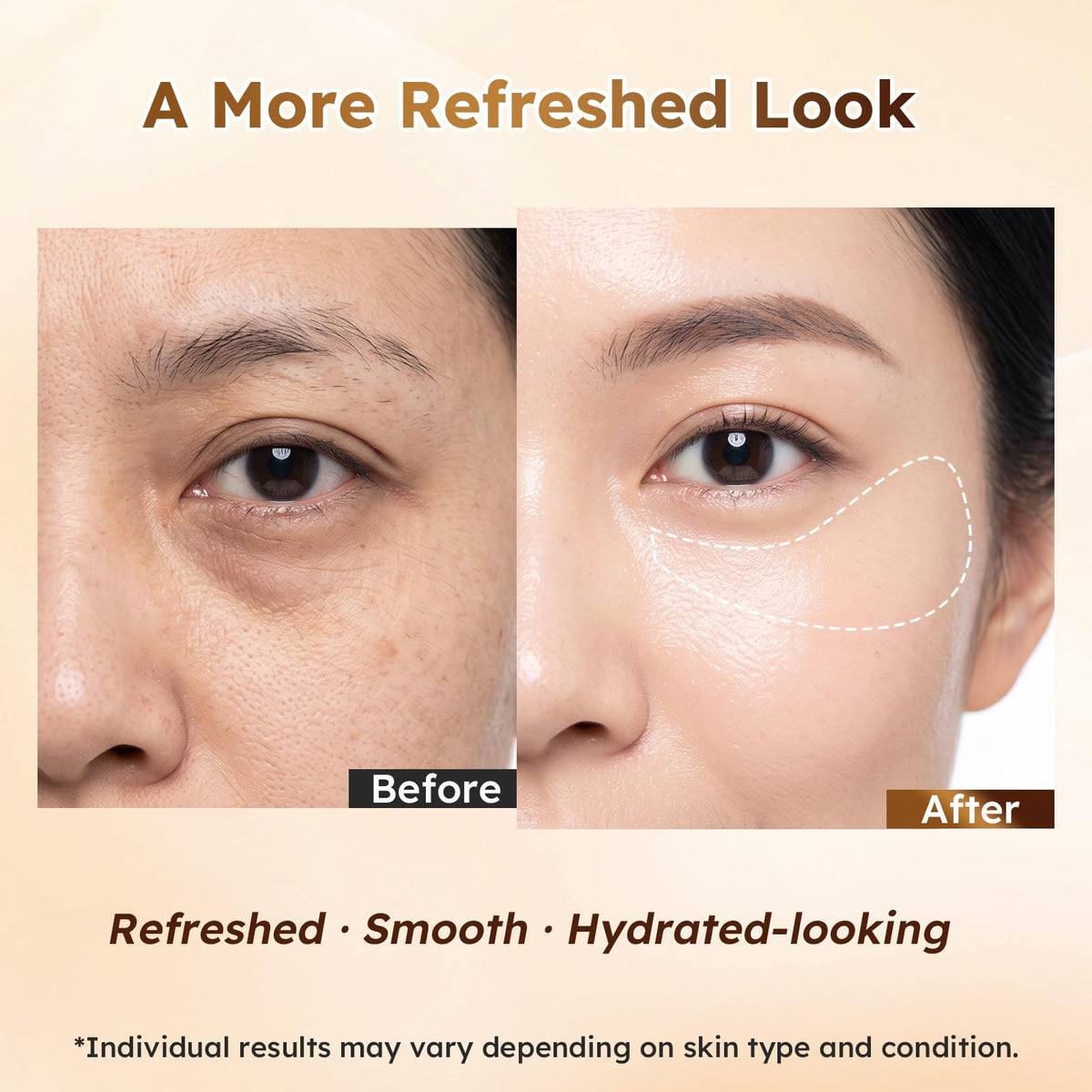 PDRN Caffeine Collagen Eye Patches for Puffy Eyes - Jessasjet Official Imagery - 6