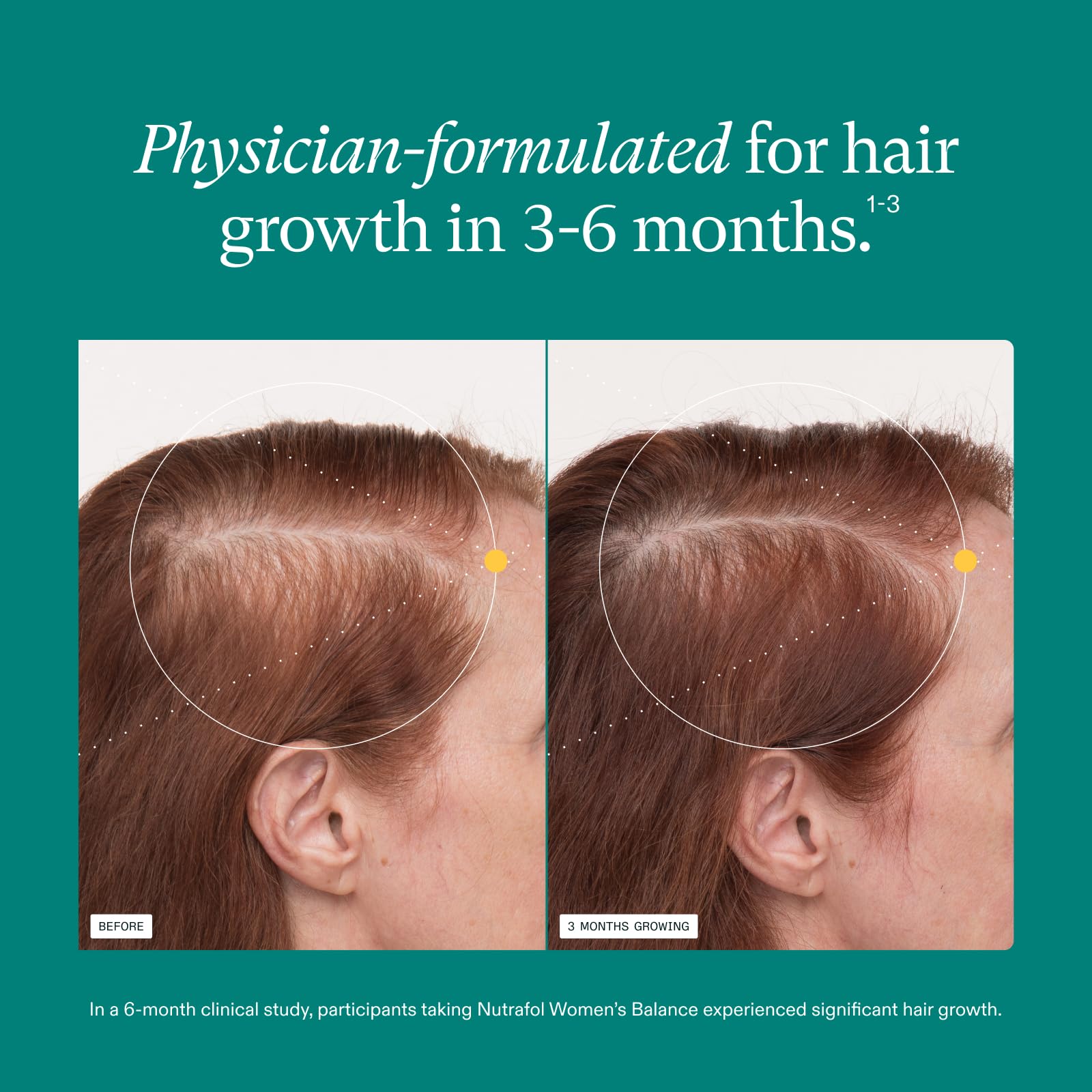 Nutrafol Women's Balance Hair Growth Supplements, Age 45+, - Generic