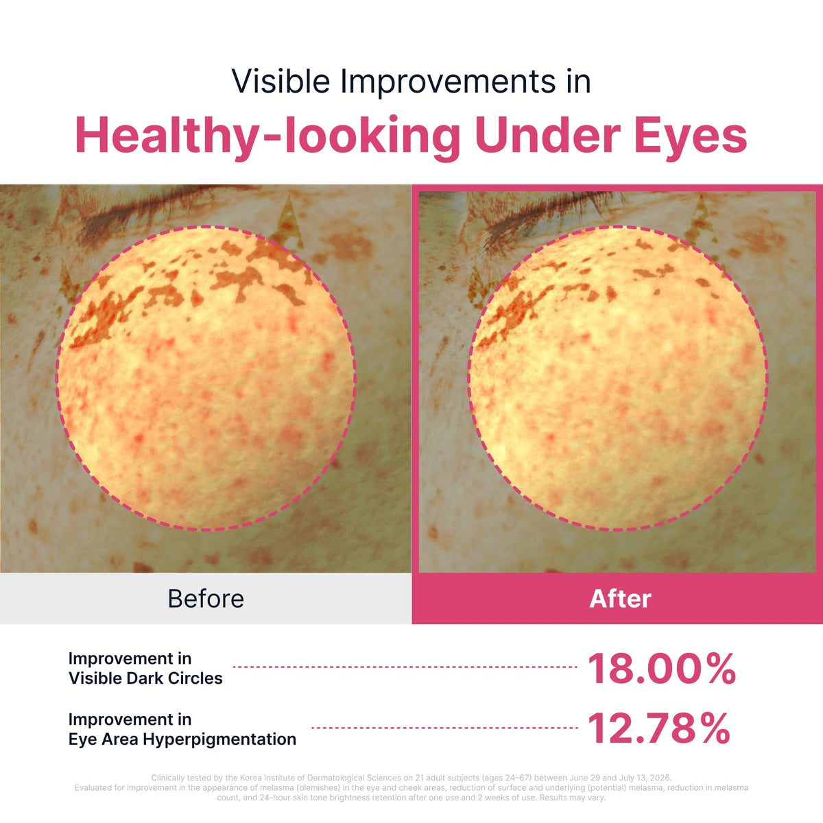 SUNGBOON EDITOR TXA Brightening Hydrogel Eye Patch 3 17 oz - SUNGBOON EDITOR Official Imagery - 4