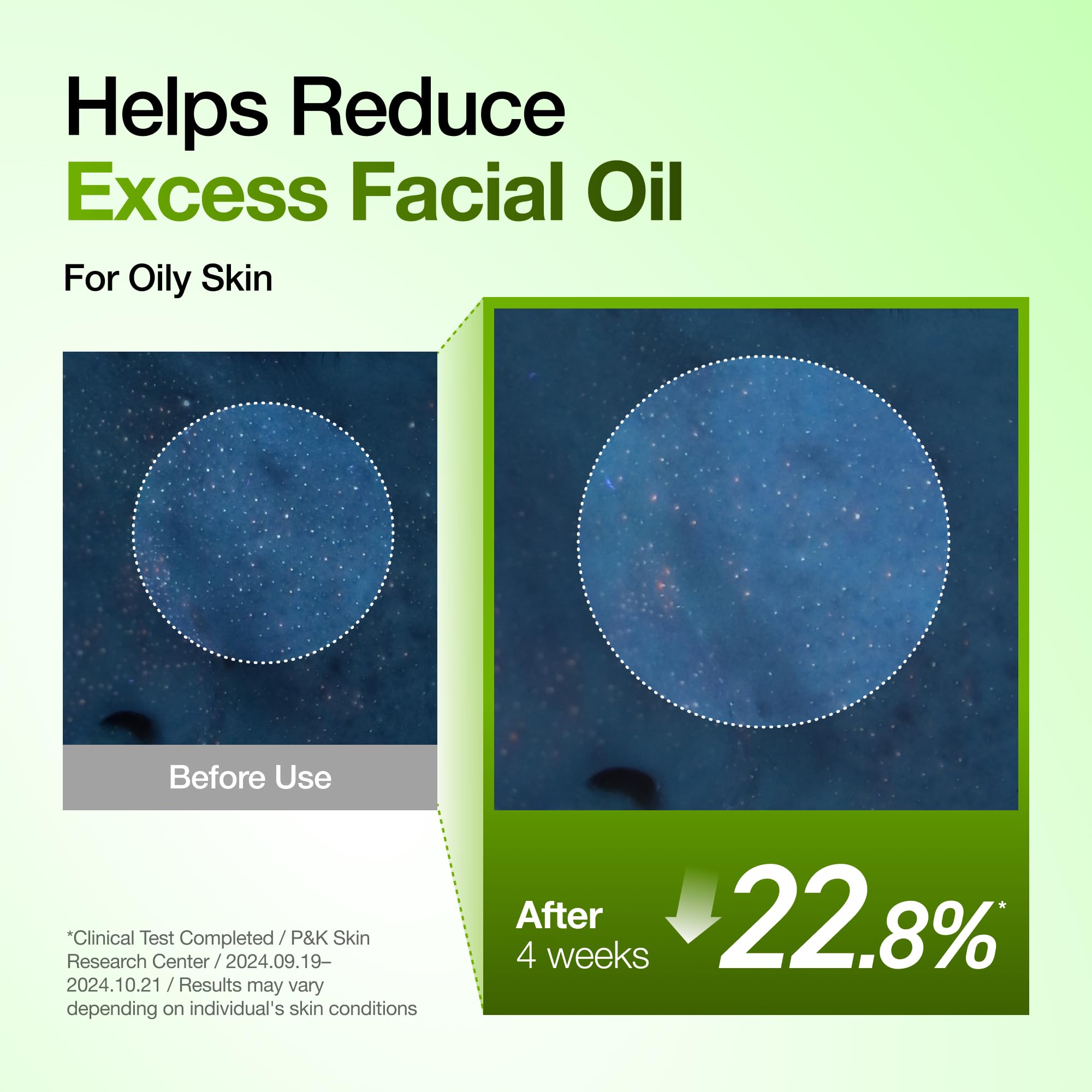 Anua Azelaic Acid 10 Hyaluron Redness Soothing Serum, 1.01 fl oz - ANUA Official Product View 8