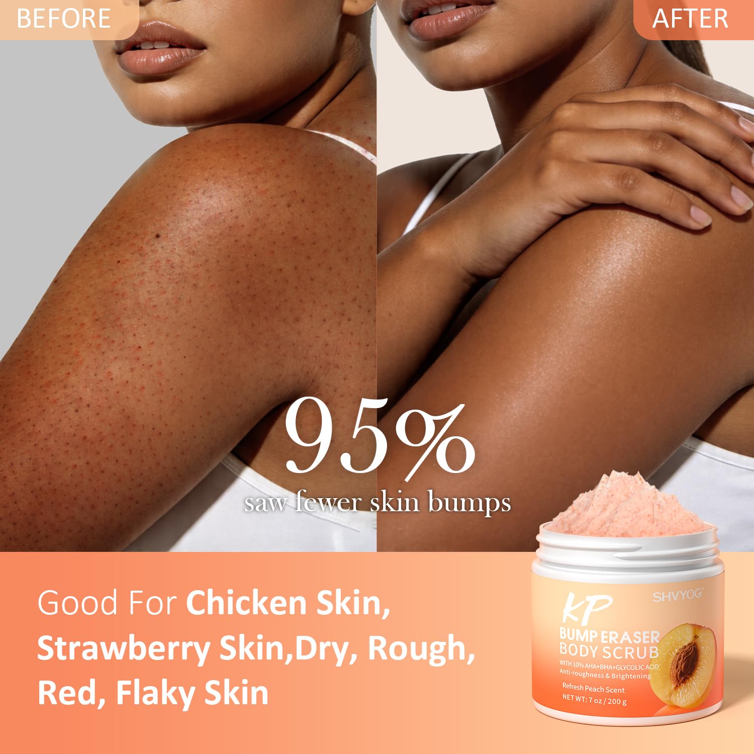 SHVYOG KP Bump Eraser Body Scrub with 10% AHA+BHA & Glycolic Acid, Exfoliating - SHVYOG Official Product View 5
