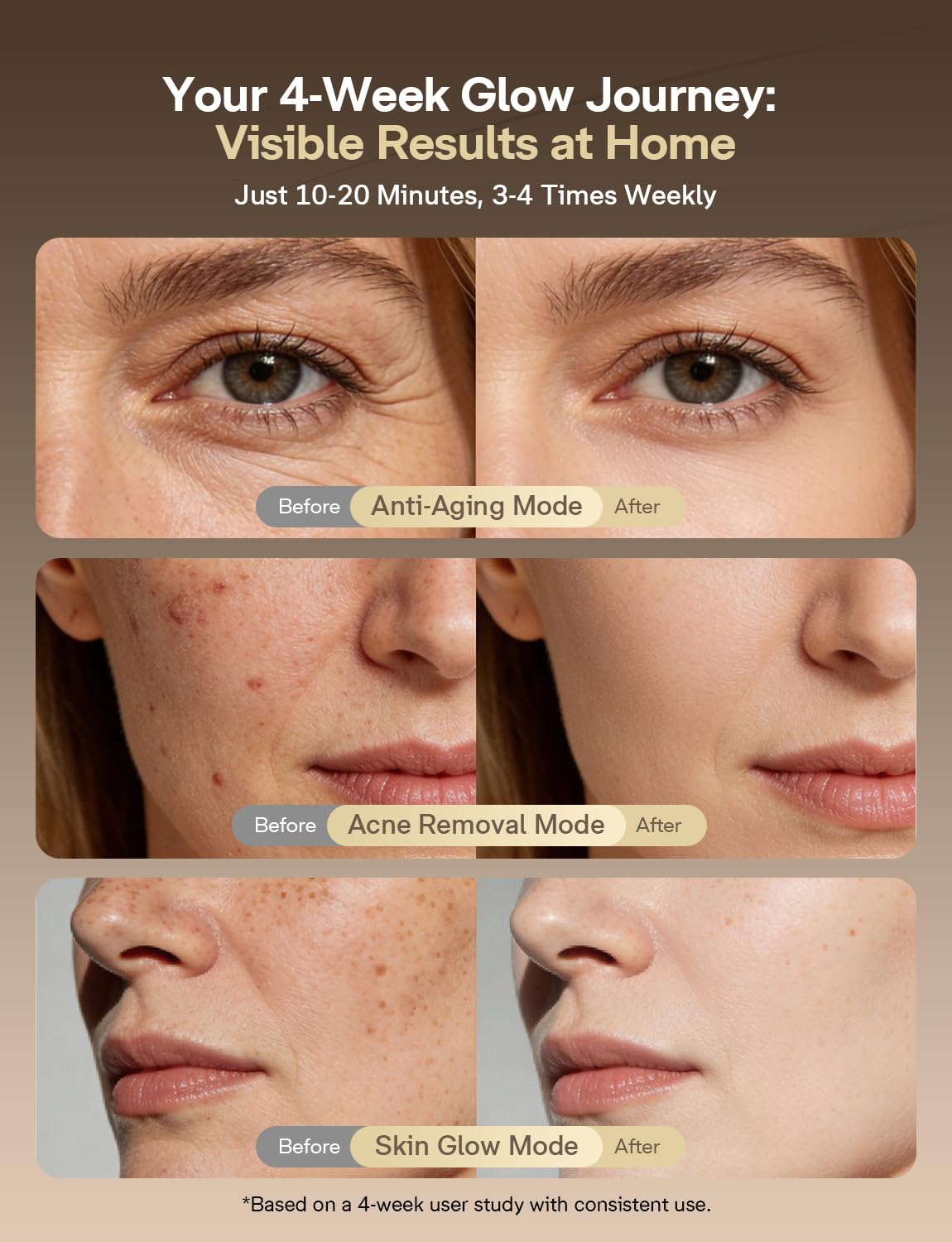 Medisana Red Light Therapy for Face 336 LEDs Wireless - Medisana Official Imagery - 6
