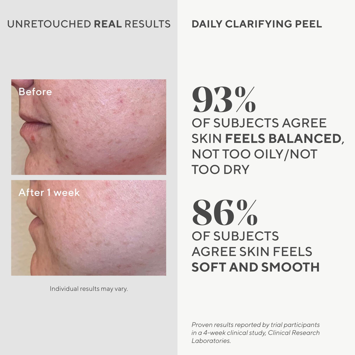 Murad Daily Clarifying Peel Retinoid Salicylic and Glycolic - Premium Selection Official Imagery - 4