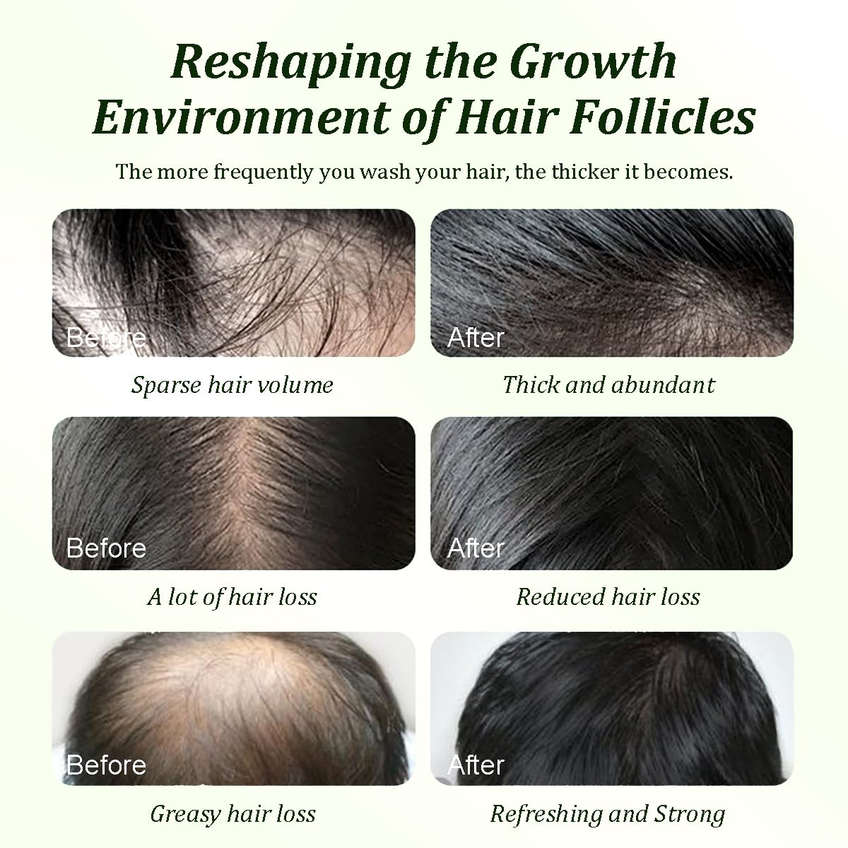 Gypsophila Batana Oil Shampoo,Rosemary Shampoo,Nourishing & Rejuvenating for - Gypsophila Official Product View 7