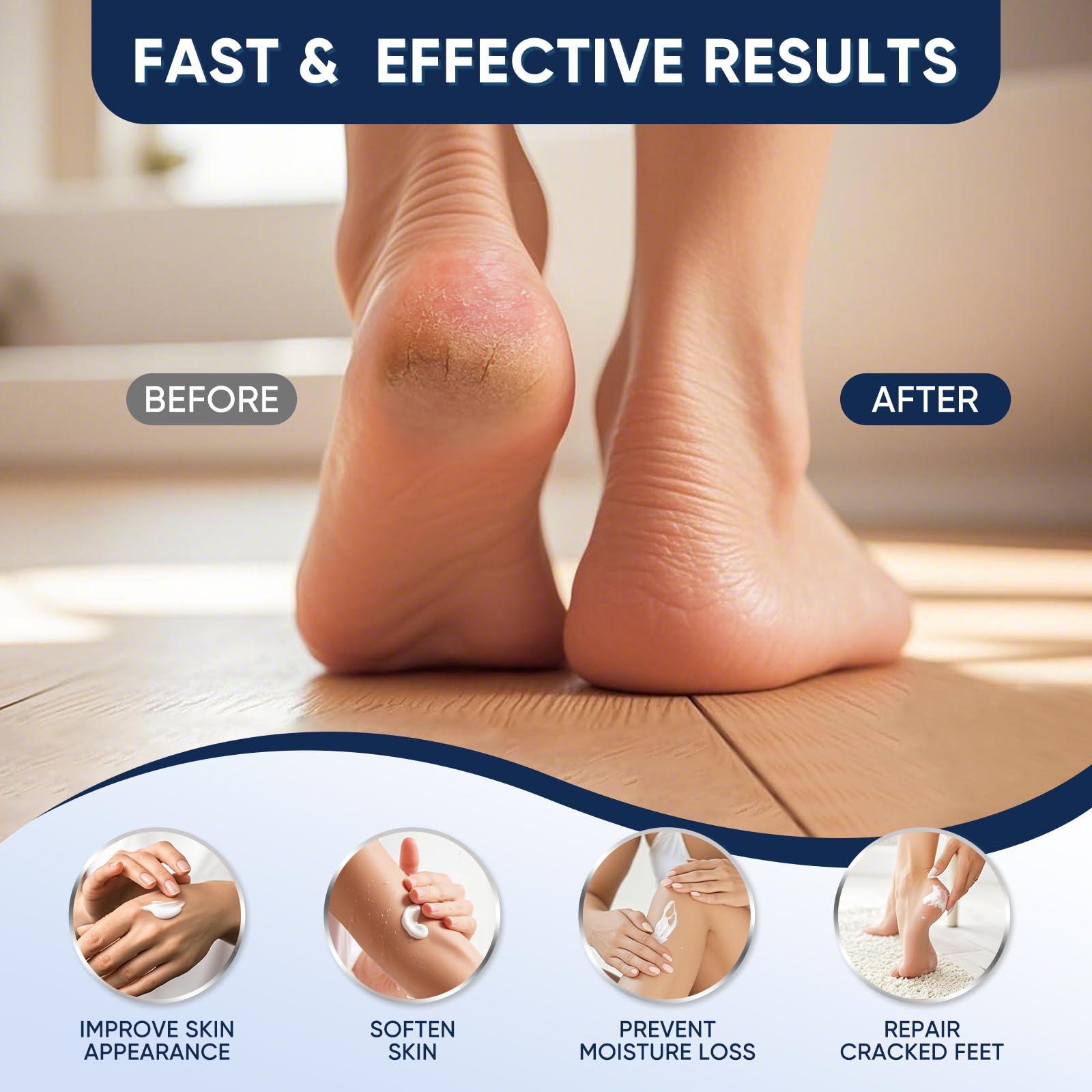 VREKEF 60% Urea and Salicylic Acid heel repair moisturizer in a 5oz tube, designed to soften and repair dry, cracked heels.
