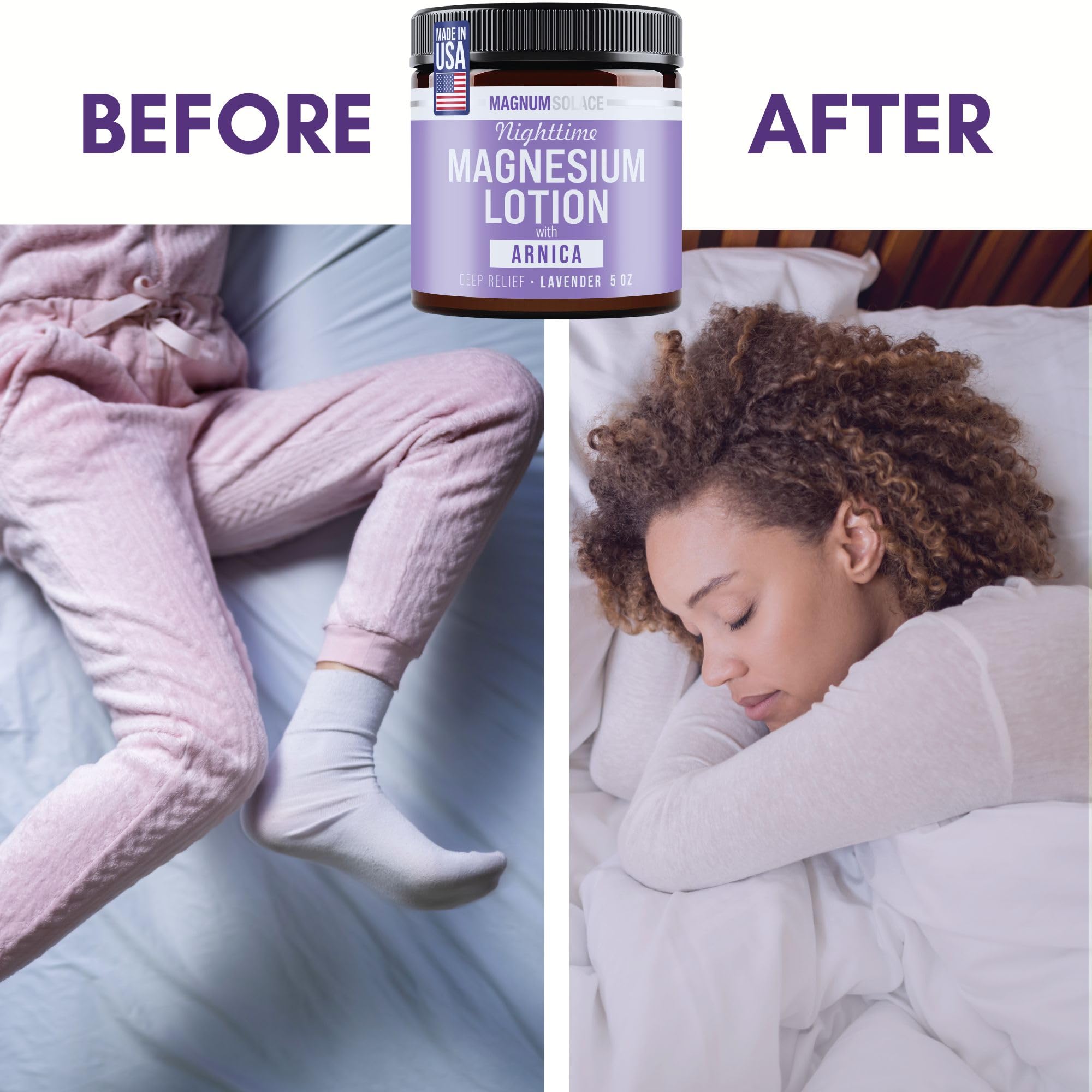 Magnum Solace Nighttime Magnesium Lotion with Arnica – Highly Concentrated Magnesium for Muscles & Joints – Apply to Legs or Feet Before Bed – Skin-Friendly