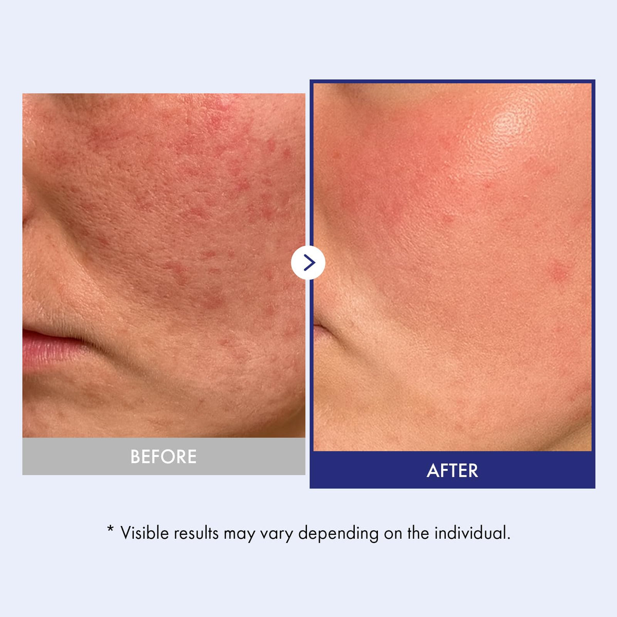 TOSOWOONG Panthenol 20 Barrier Cream for Soothing Hydrating - TOSOWOONG Official Product Imagery - 5