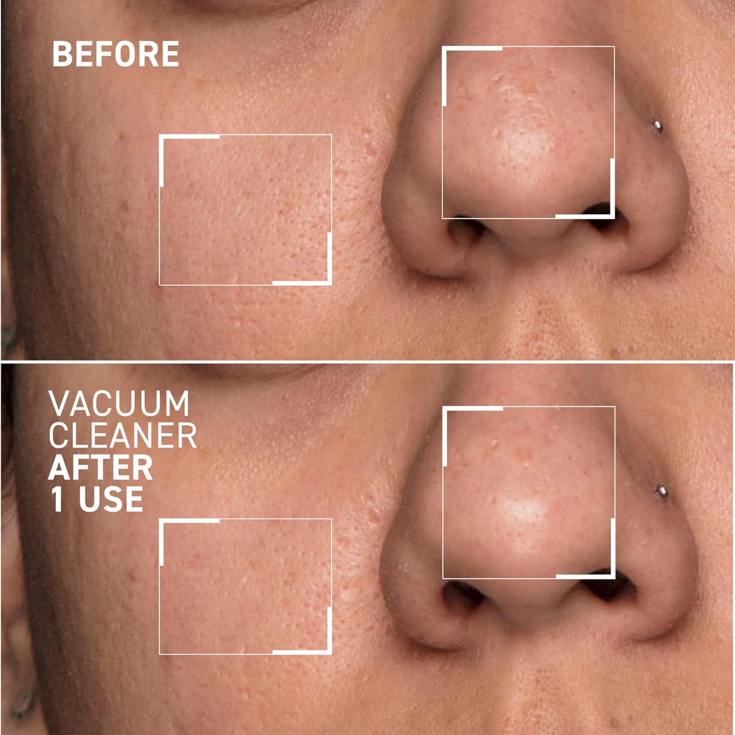 Dr. Brandt Pores No More Vacuum Cleaner pore-purifying mask in a sleek jar, designed to cleanse and minimize pores.
