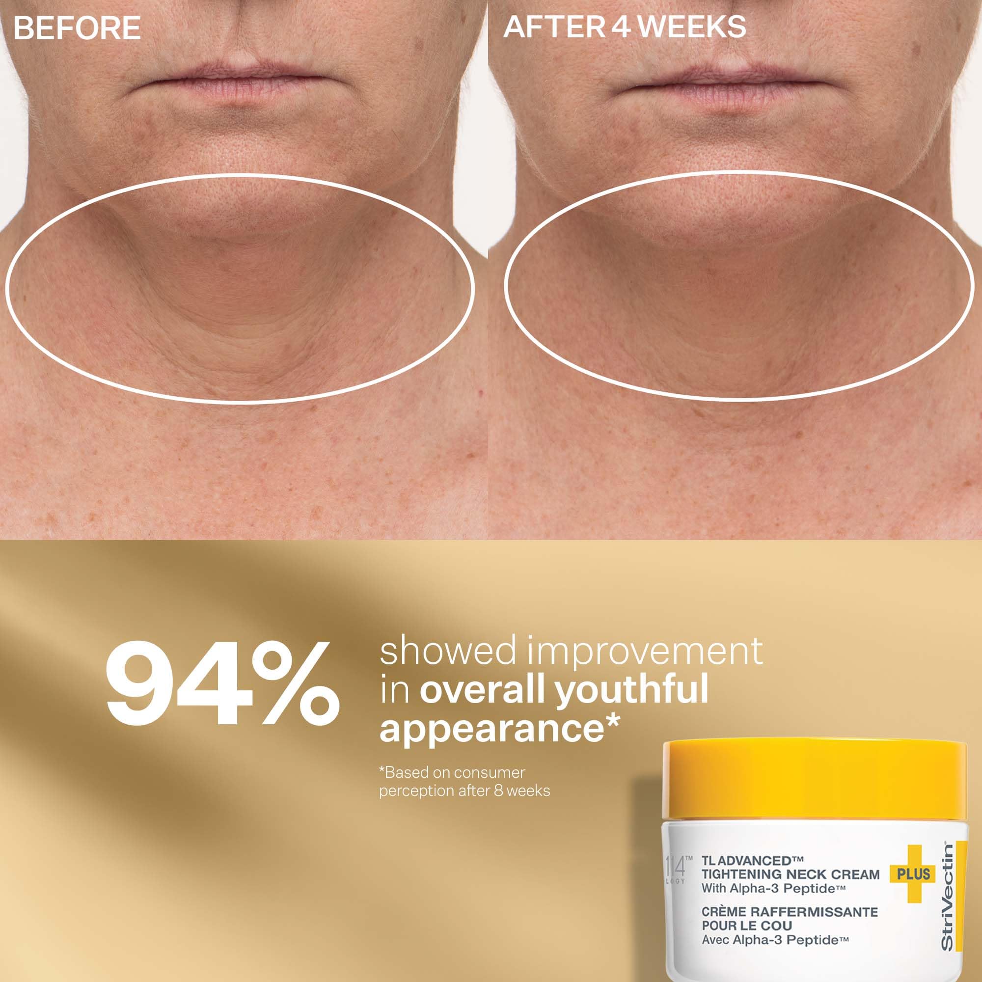StriVectin Tighten Lift Peptight Face Lift Serum with - Premium Selection Official Imagery - 7