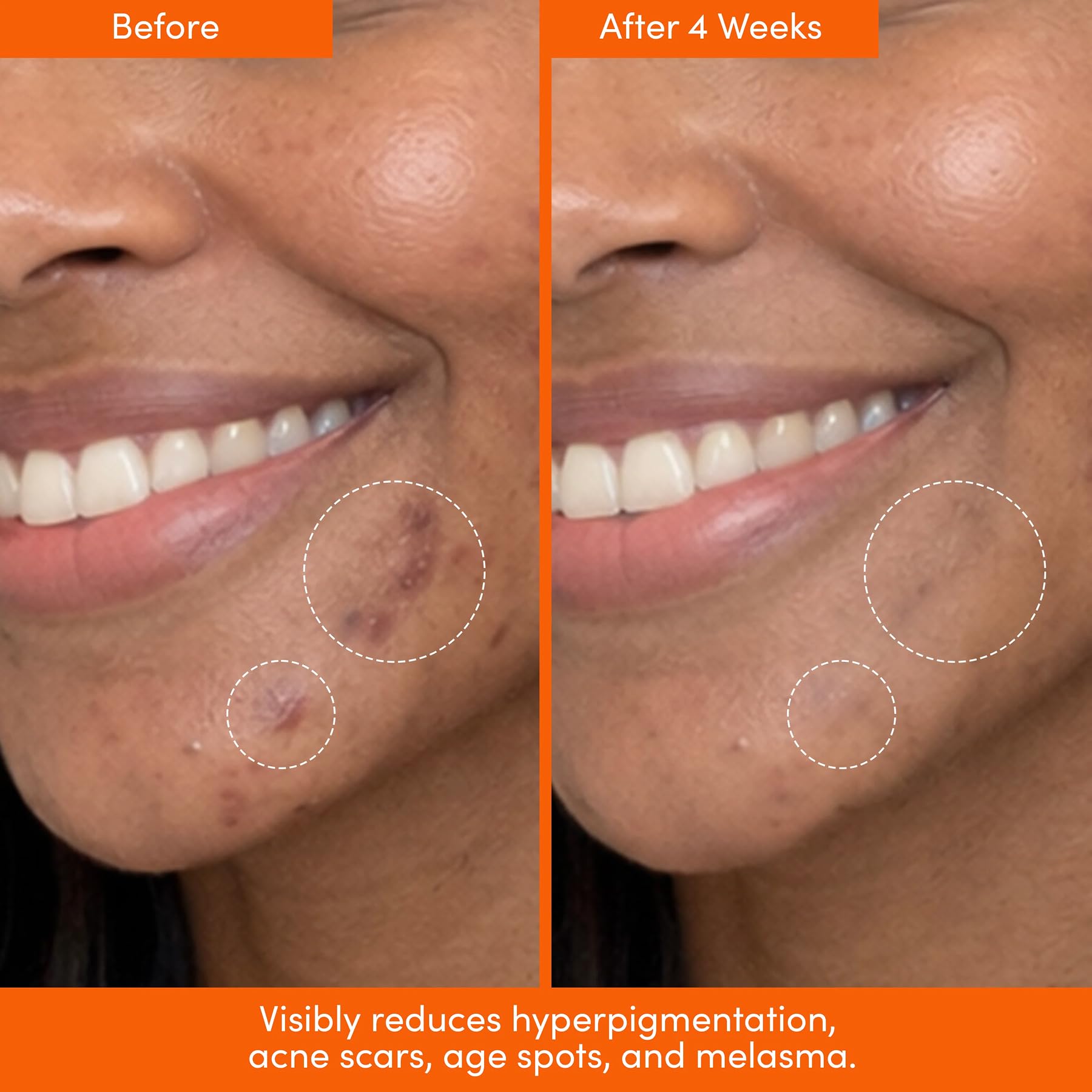Tranexamic Acid Dark Spot Serum Exfoliating AHA for Face - LION POSE Official Imagery - 6