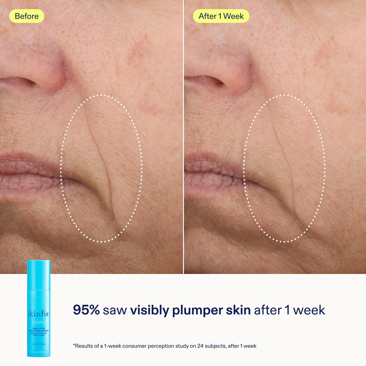 Skinfix Barrier Better Skin Starts Here Kit - Skinfix Official Imagery - 7