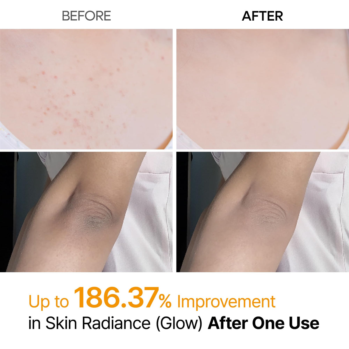 Dr Melaxin Peel Shot Kojic Acid Turmeric Body Exfoliator - Dr.Melaxin Official Imagery - 4