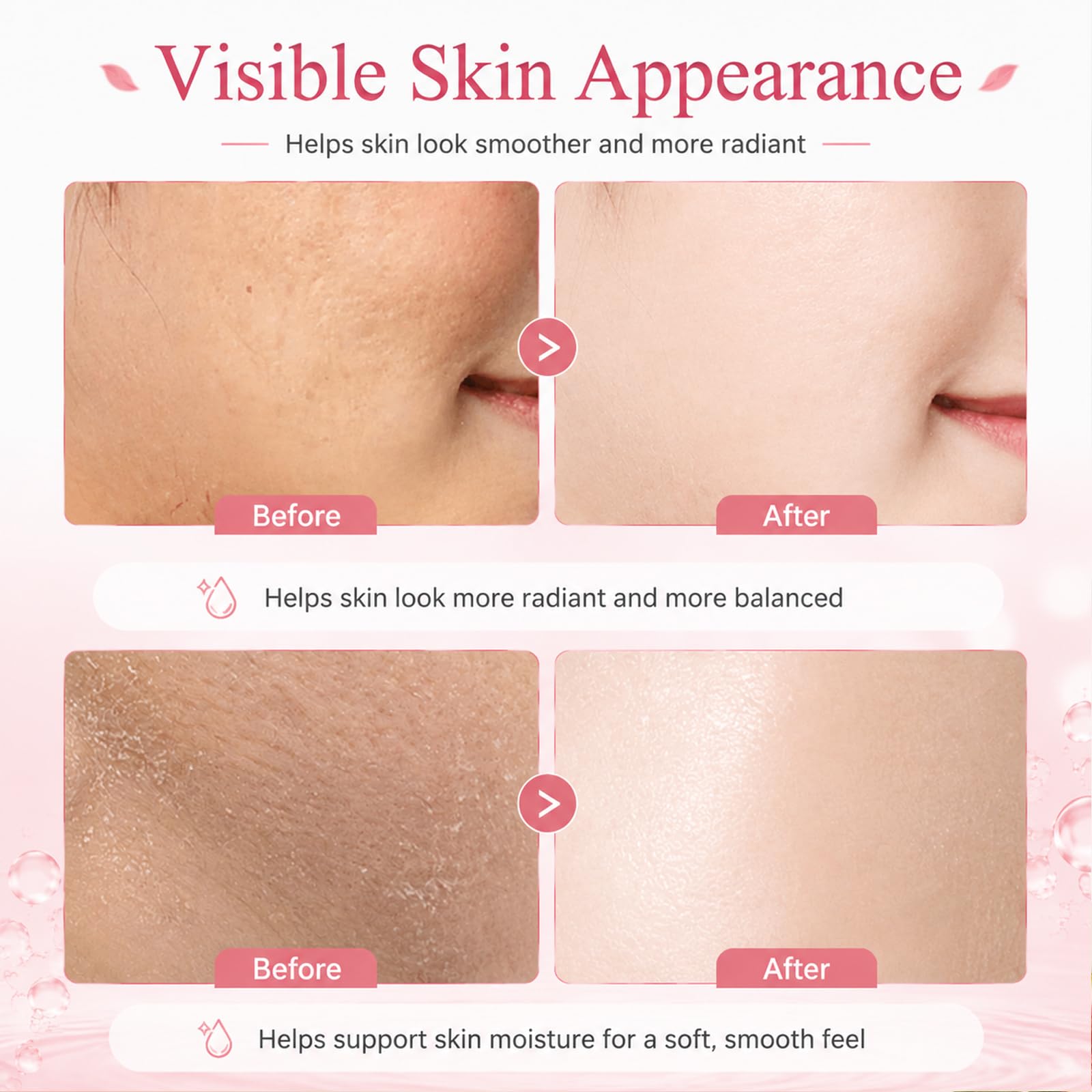 6PCS Figs Korean Skin Care Set, Moisturizing Korean Facial Kits - Jiakale