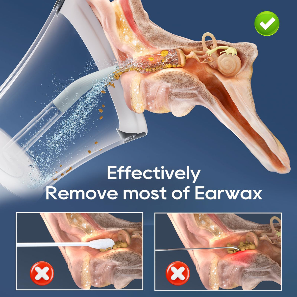 Ear Wax Removal Effective Safe Electric Ear Clean Kit for - Morfone Official Imagery - 3