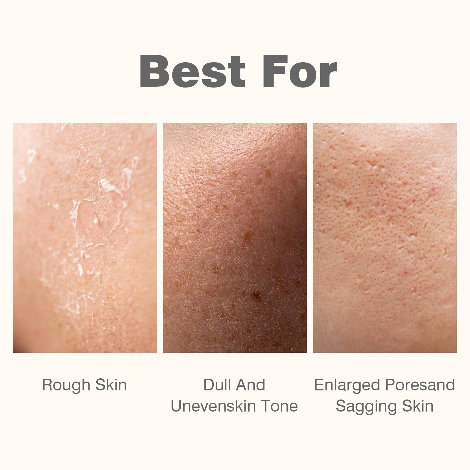 IREV Rice Sheet Mask, Skin Care Face Mask, Hydrating Rice Mask, - IREV