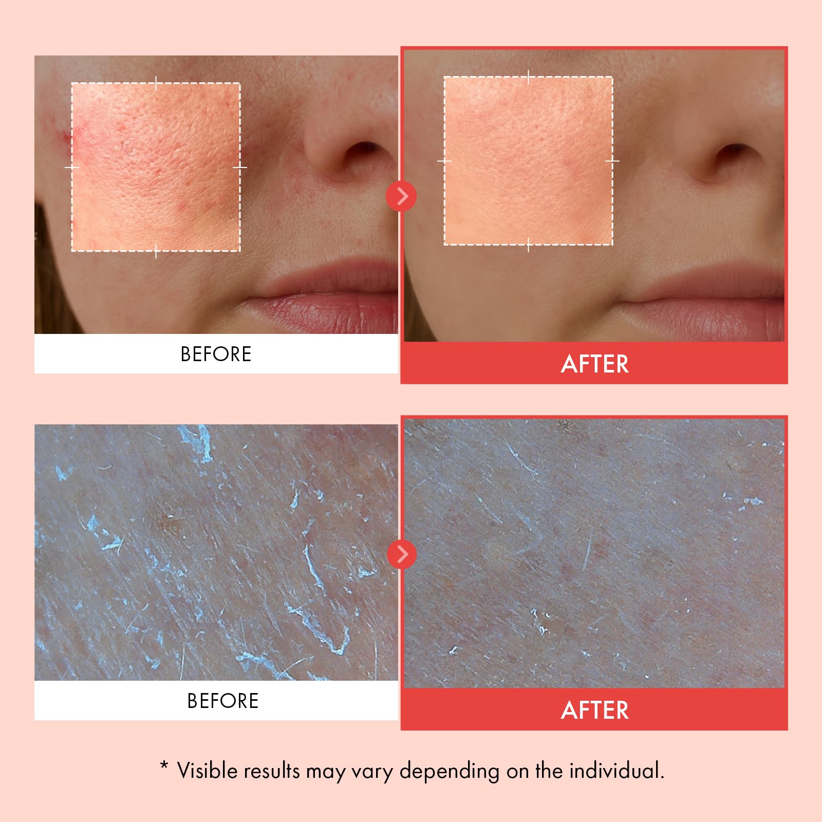 TOSOWOONG Mandelic Acid 2 Cream AHA Exfoliator for Dark - TOSOWOONG Official Imagery - 4