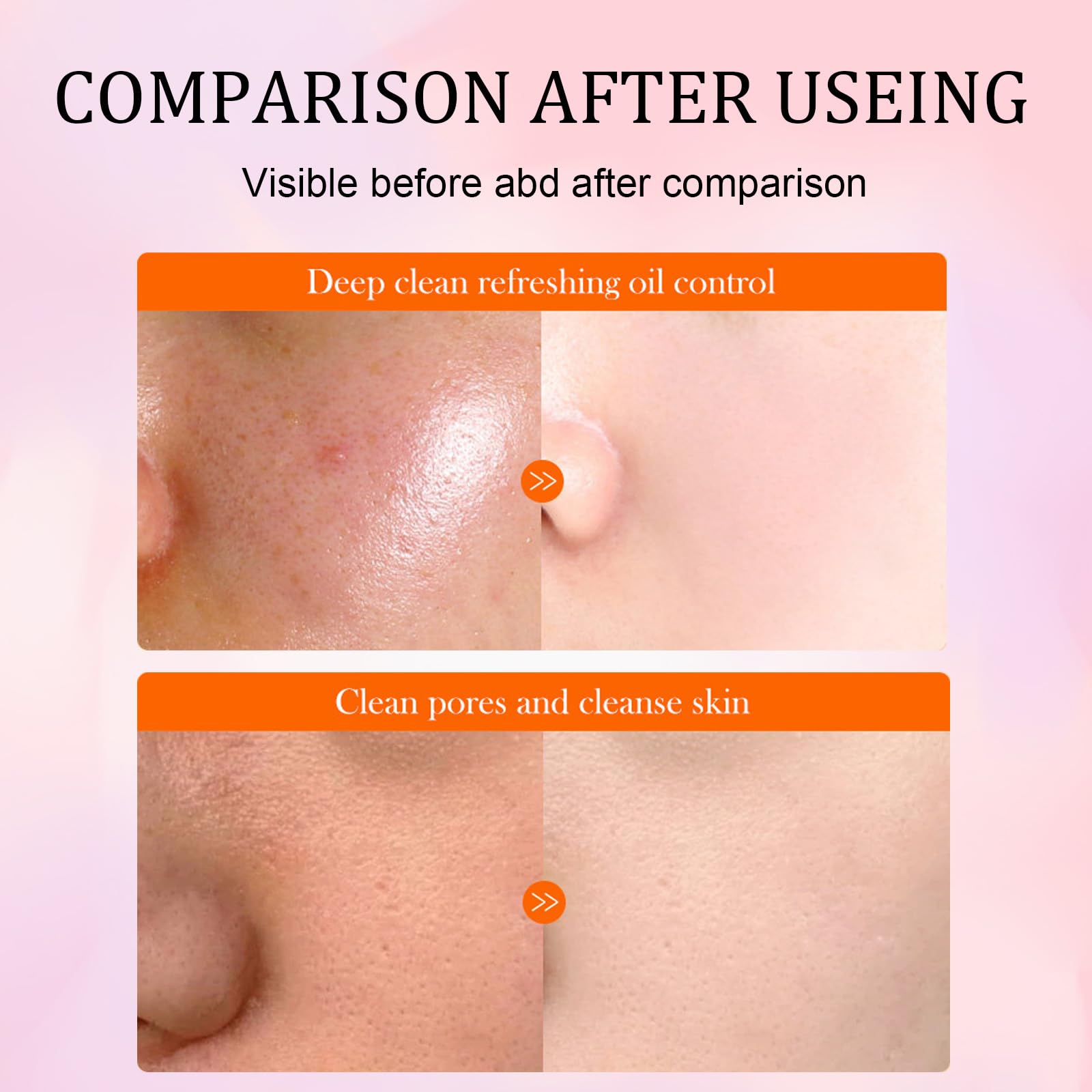 NureBe 5X Vitamin C Face Cleanser 100g with Niacinamide & Hyaluronic A - View 8