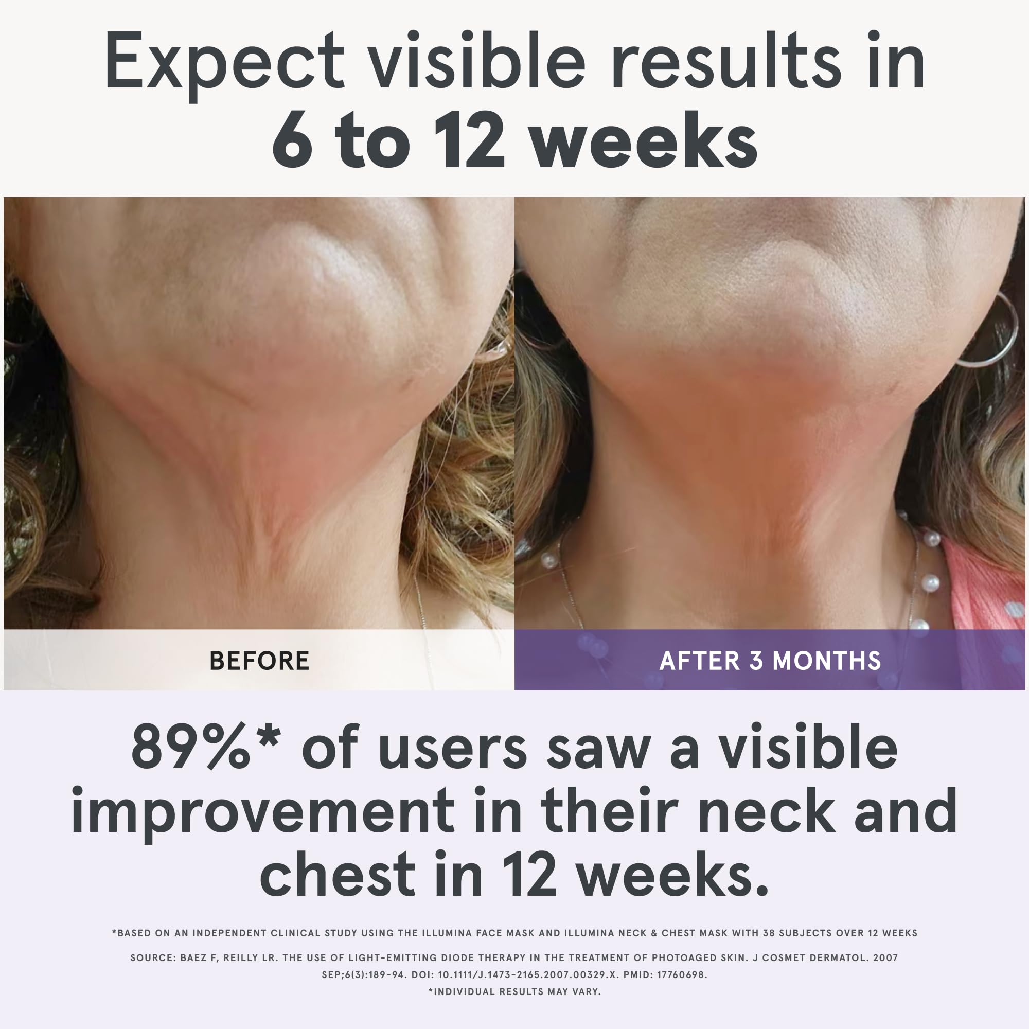 iRestore Illumina LED Neck &amp; Chest Anti Aging Mask – for - iRe
