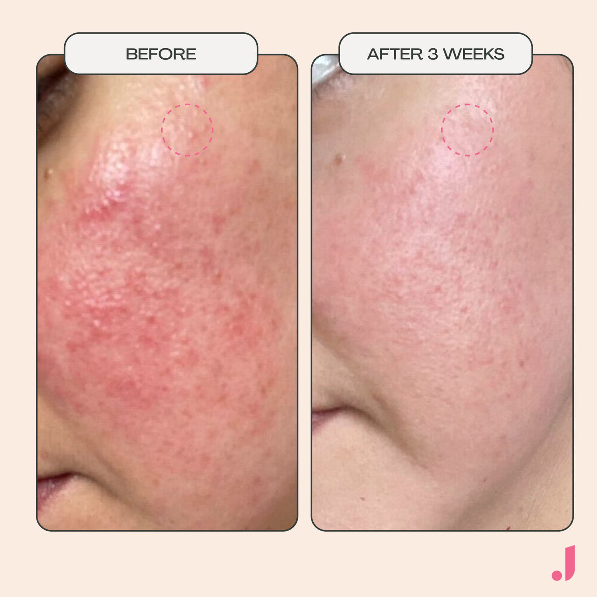 JESS BEAUTY - JESS BEAUTY Official Imagery - 8