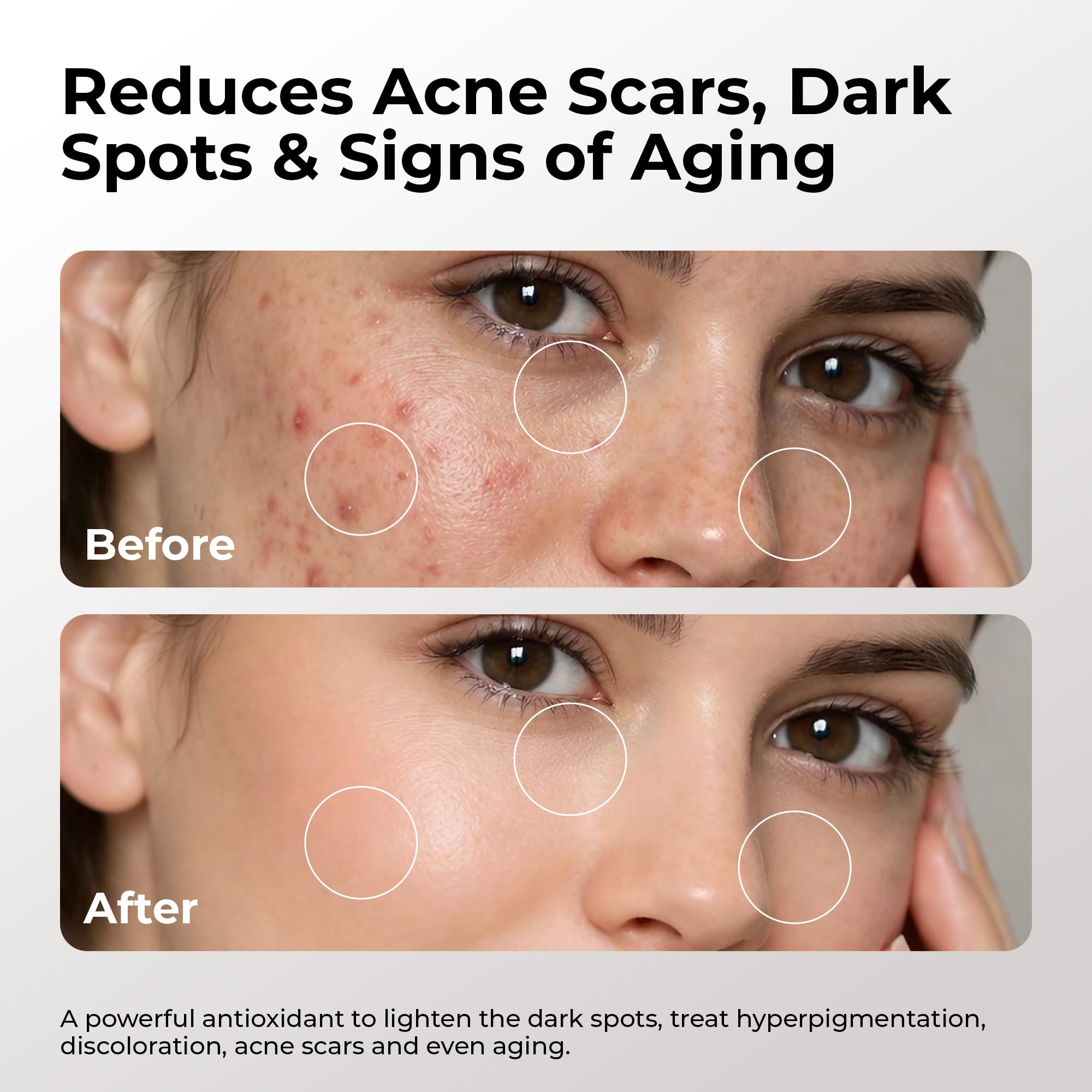 Skin Deva 20% Vitamin C Serum Anti Aging with Hyaluronic Acid & Vitamin E - SKIN DEVA Official Product View 7